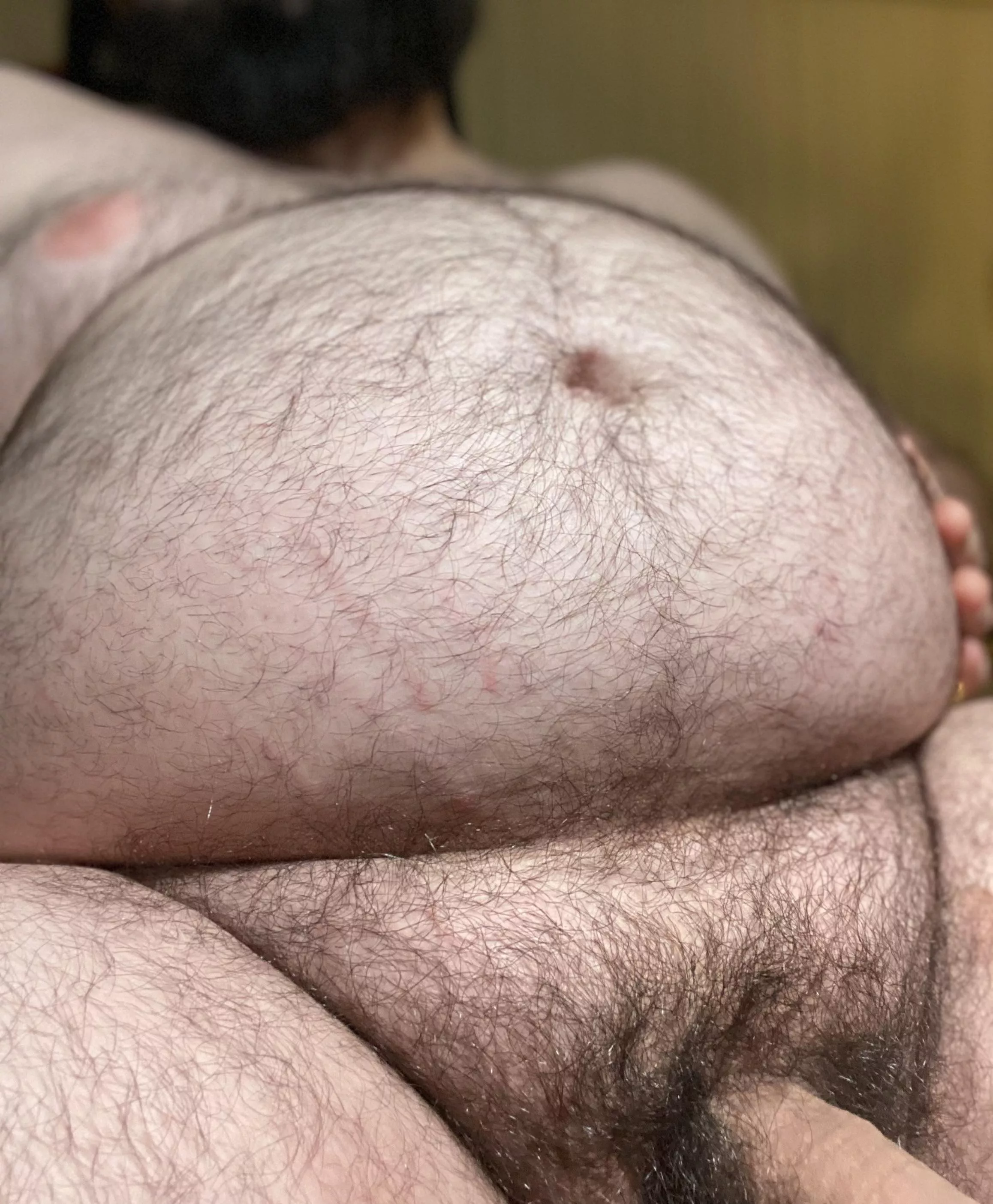 My Not So Sneaky Stretchmarks posted by AutomaticallyAll