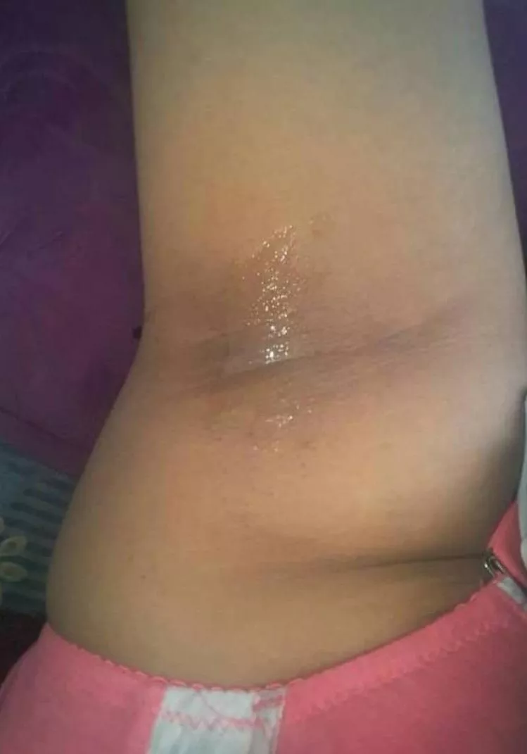 My roomie has turned the heater on full from her room. Woke up like this🙄 posted by nayantarap108