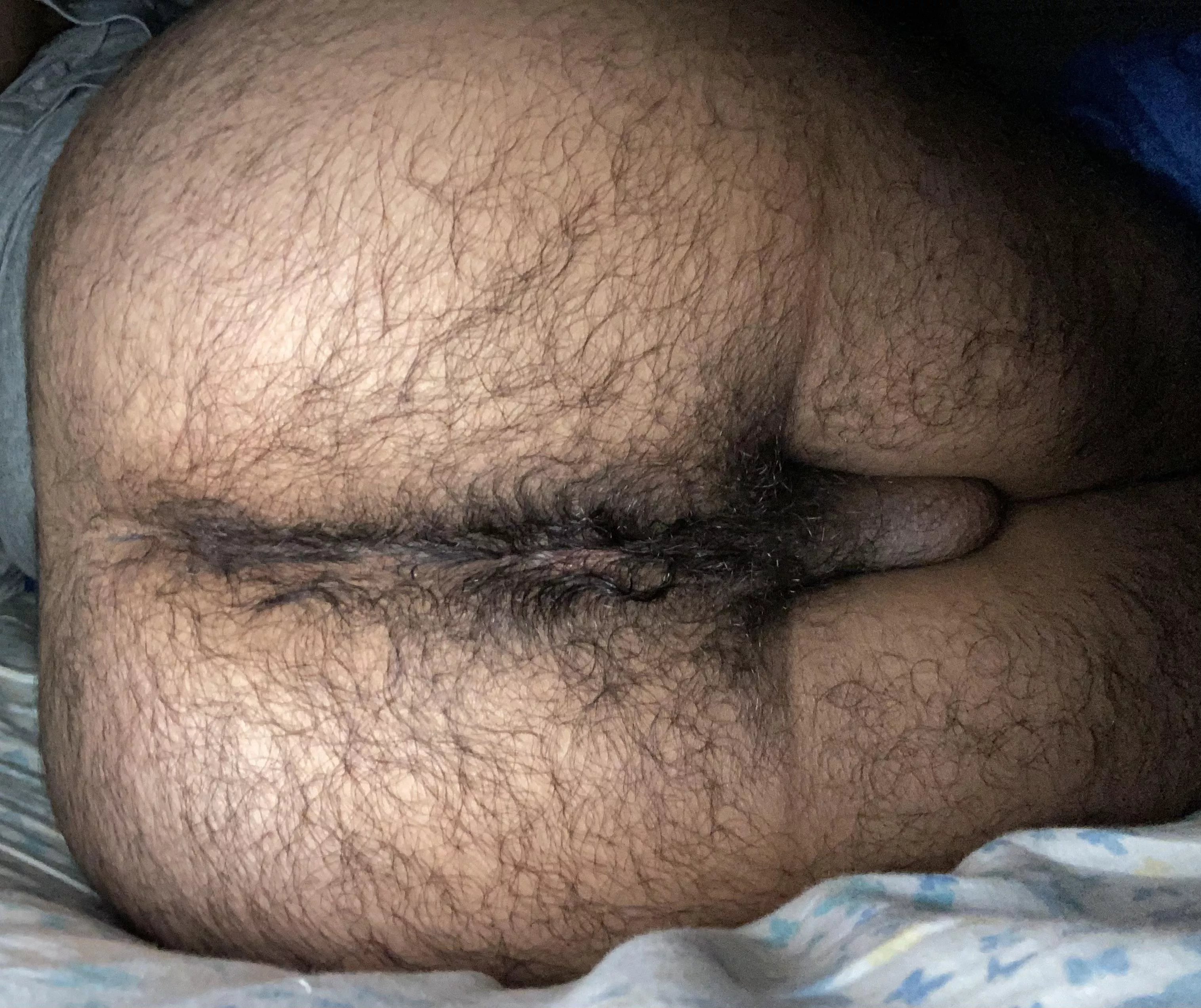 [19] Hairy enough? posted by Tight-Significance44