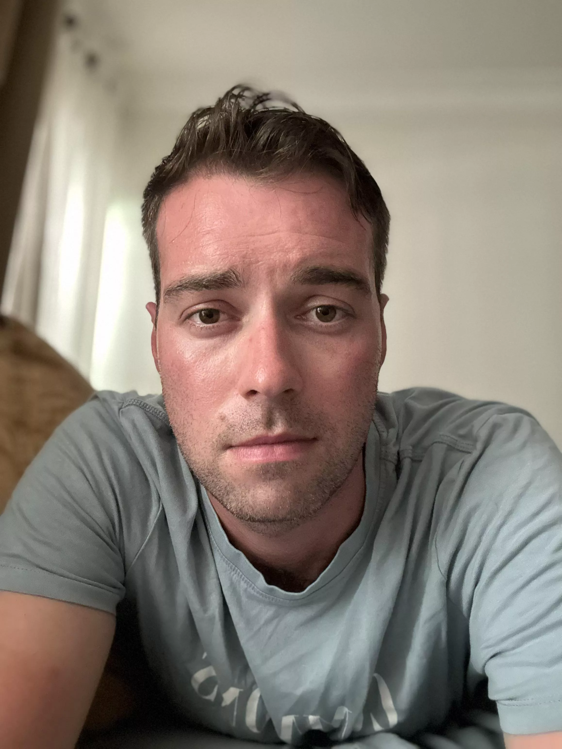 Sunburn sucks. posted by Rorz92