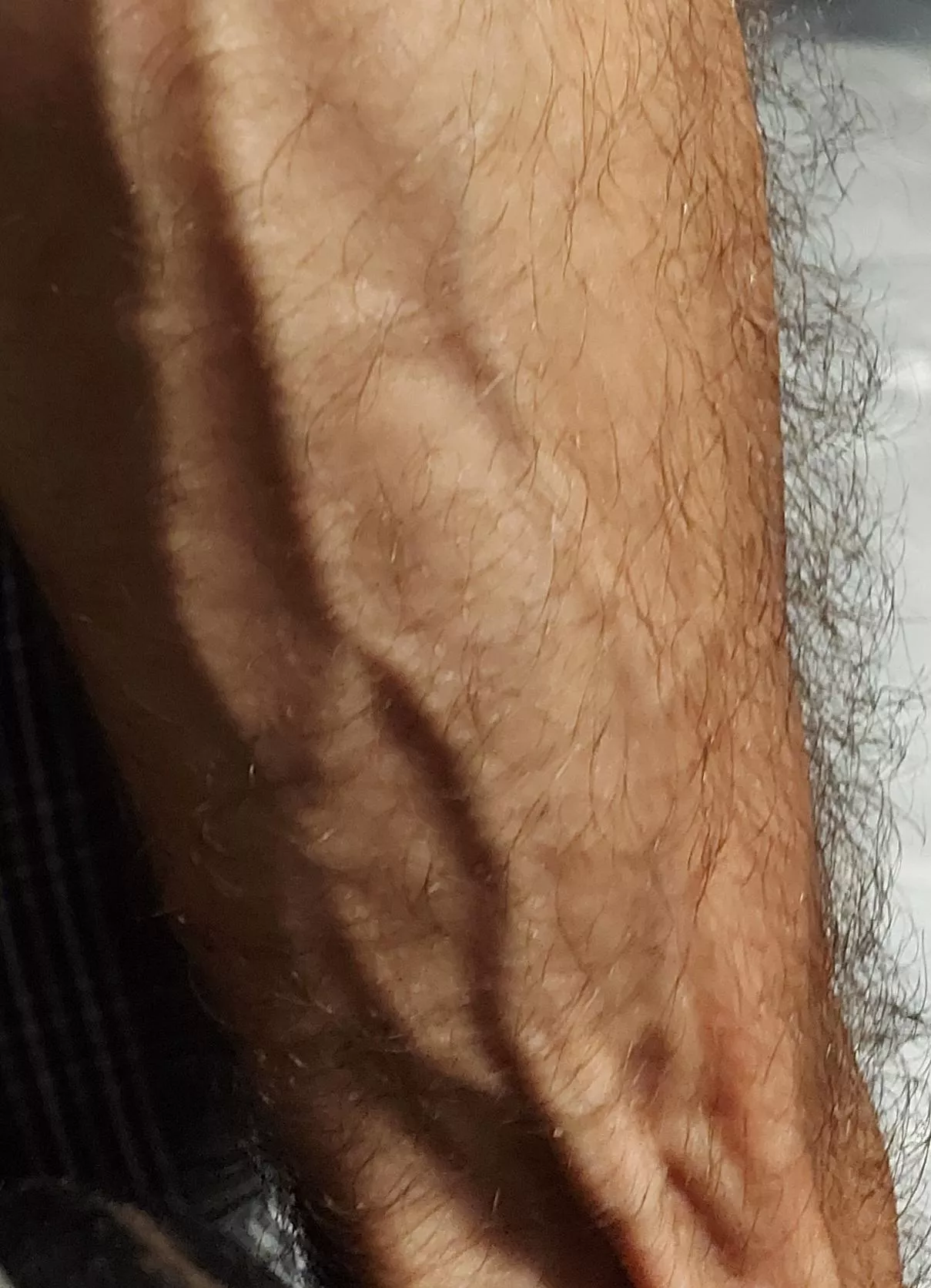 Do you like em hairy? posted by Backburning