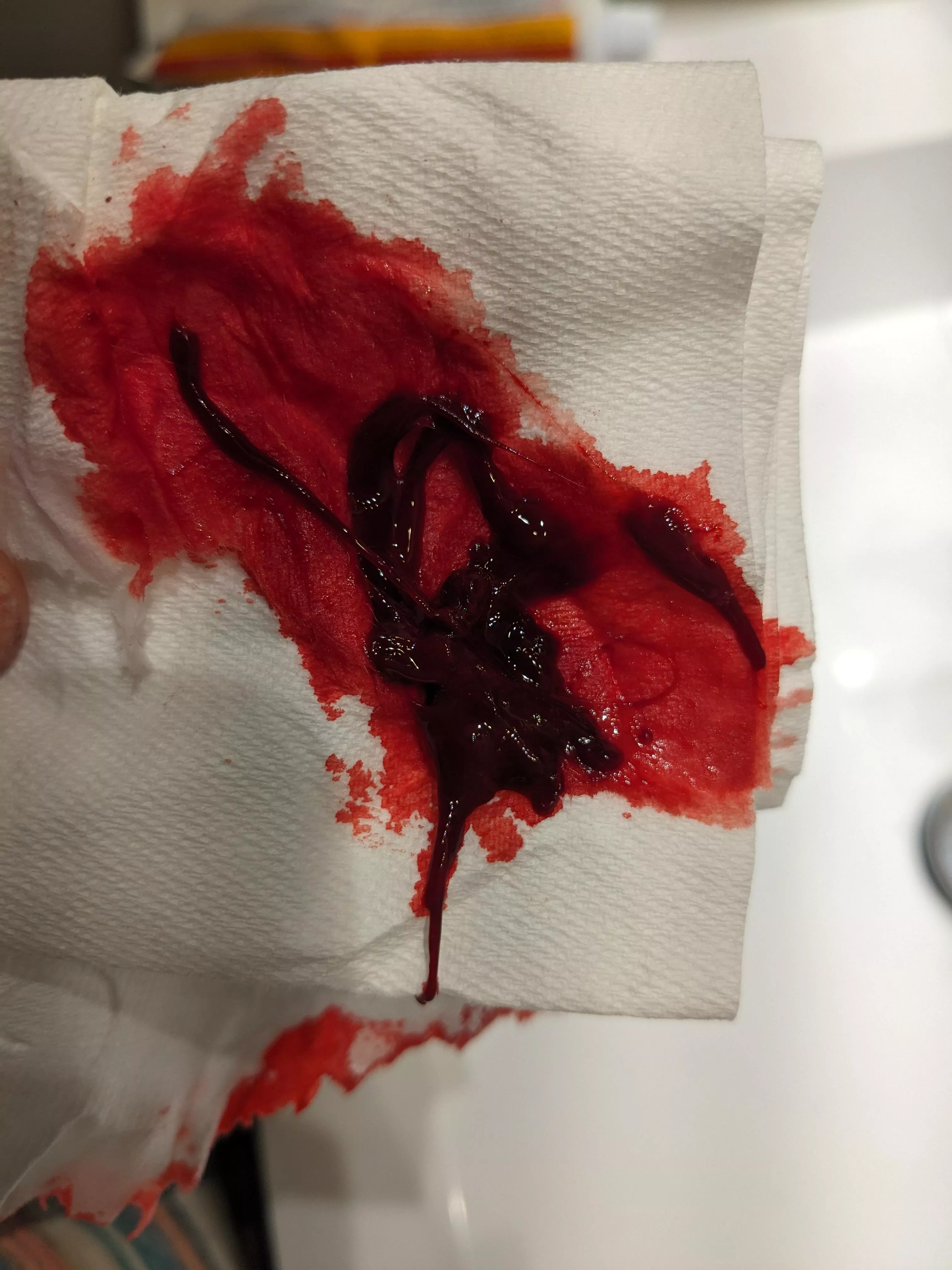 Dopeass clot (so blood, obvs) posted by Ready-Guidance4145