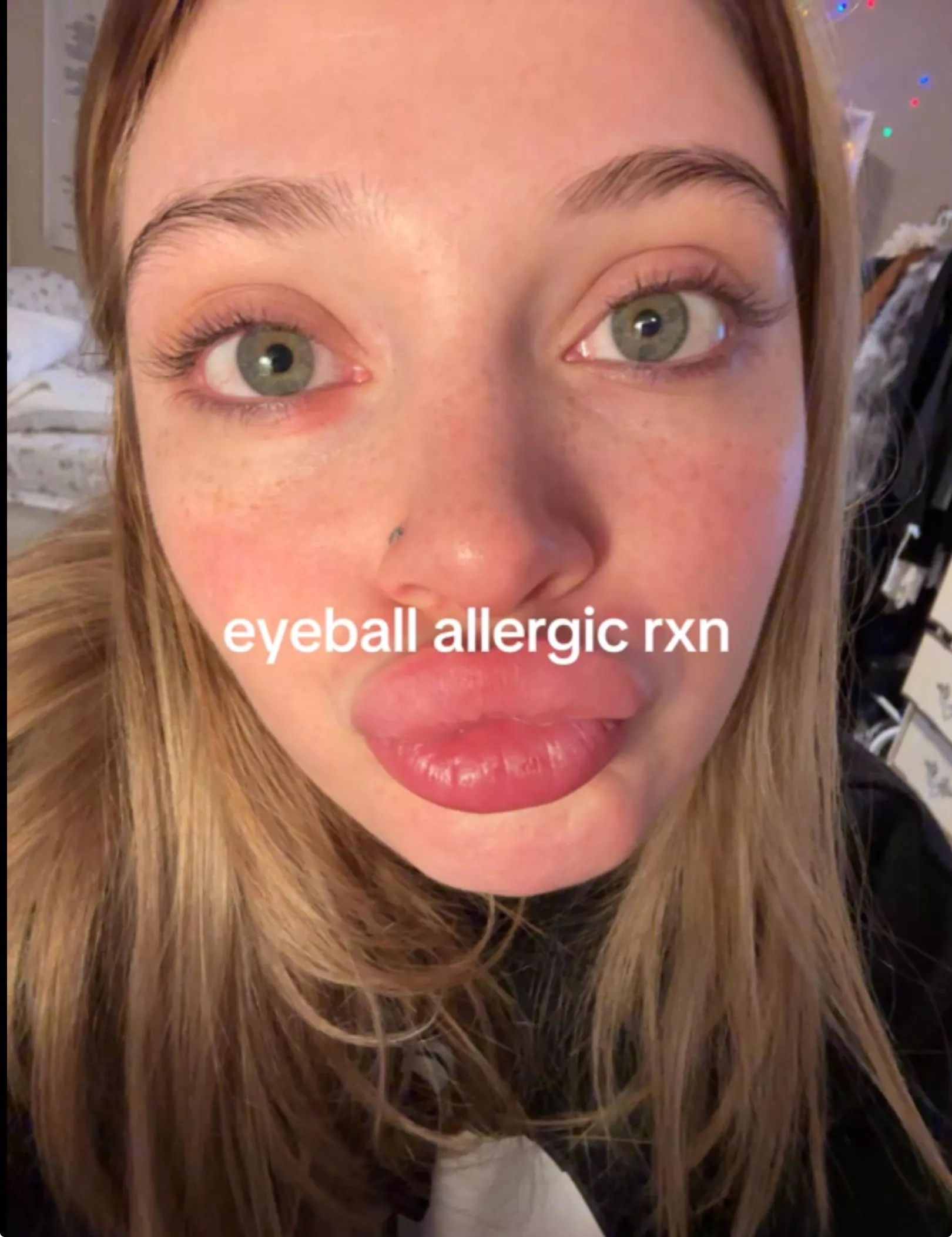 Lips posted by CreativeImpression91