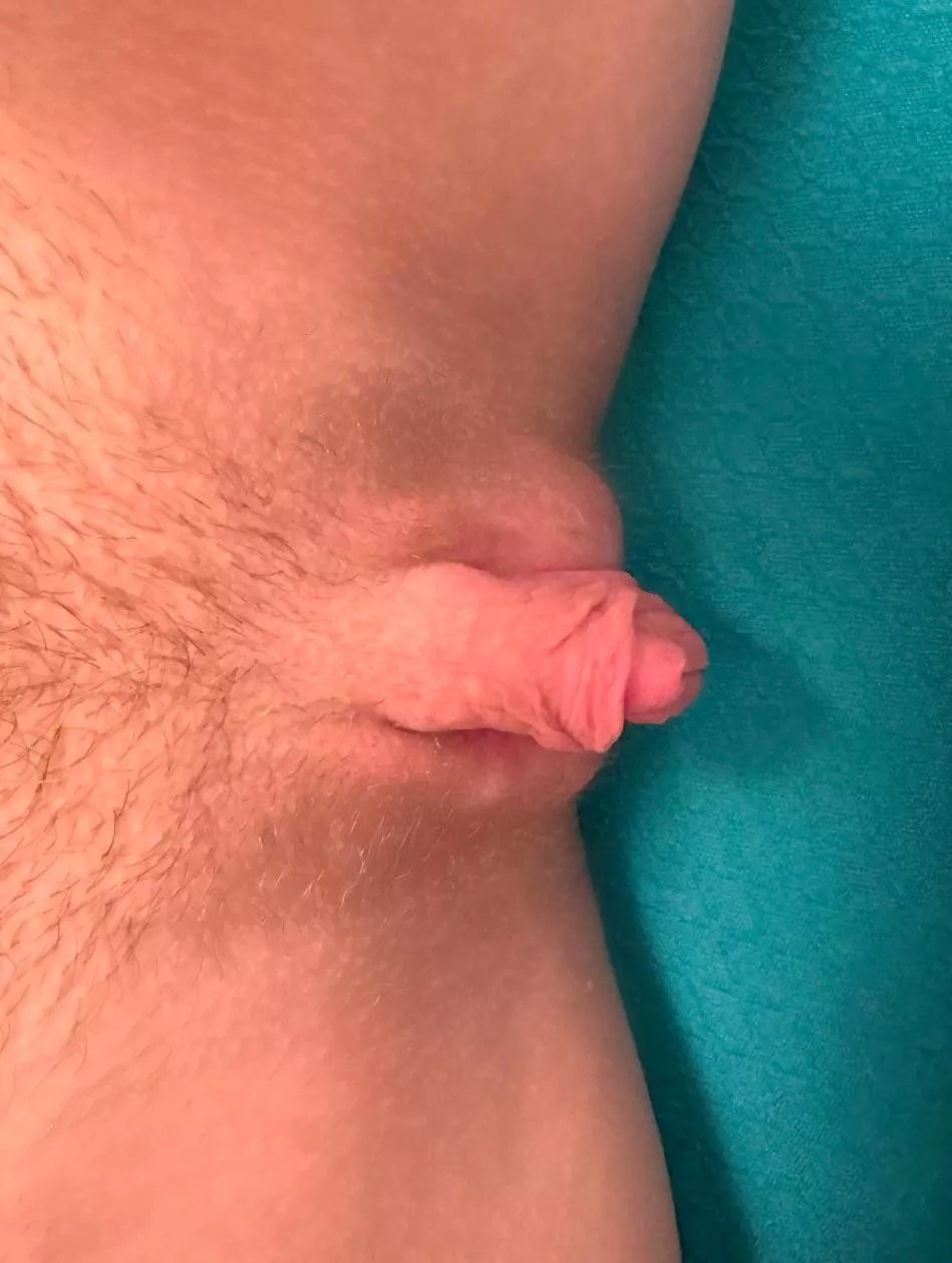 What happens when I’m all swollen? posted by PlasticPrune9658