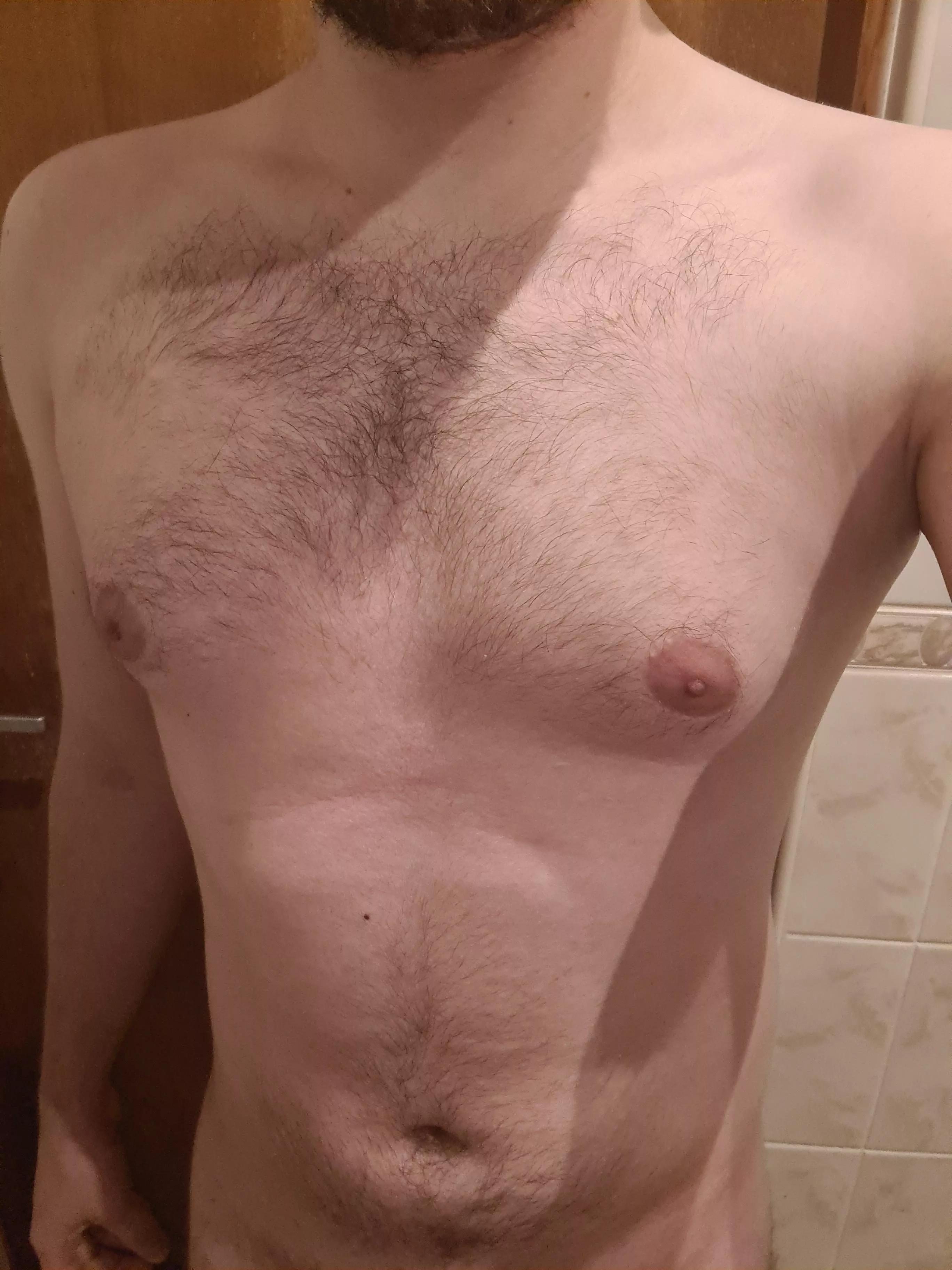 Am I to hairy for a teen posted by New-Conference2491