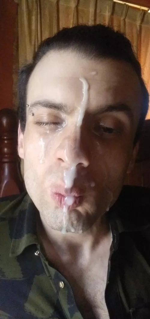 My eye is glazed shut by snack217