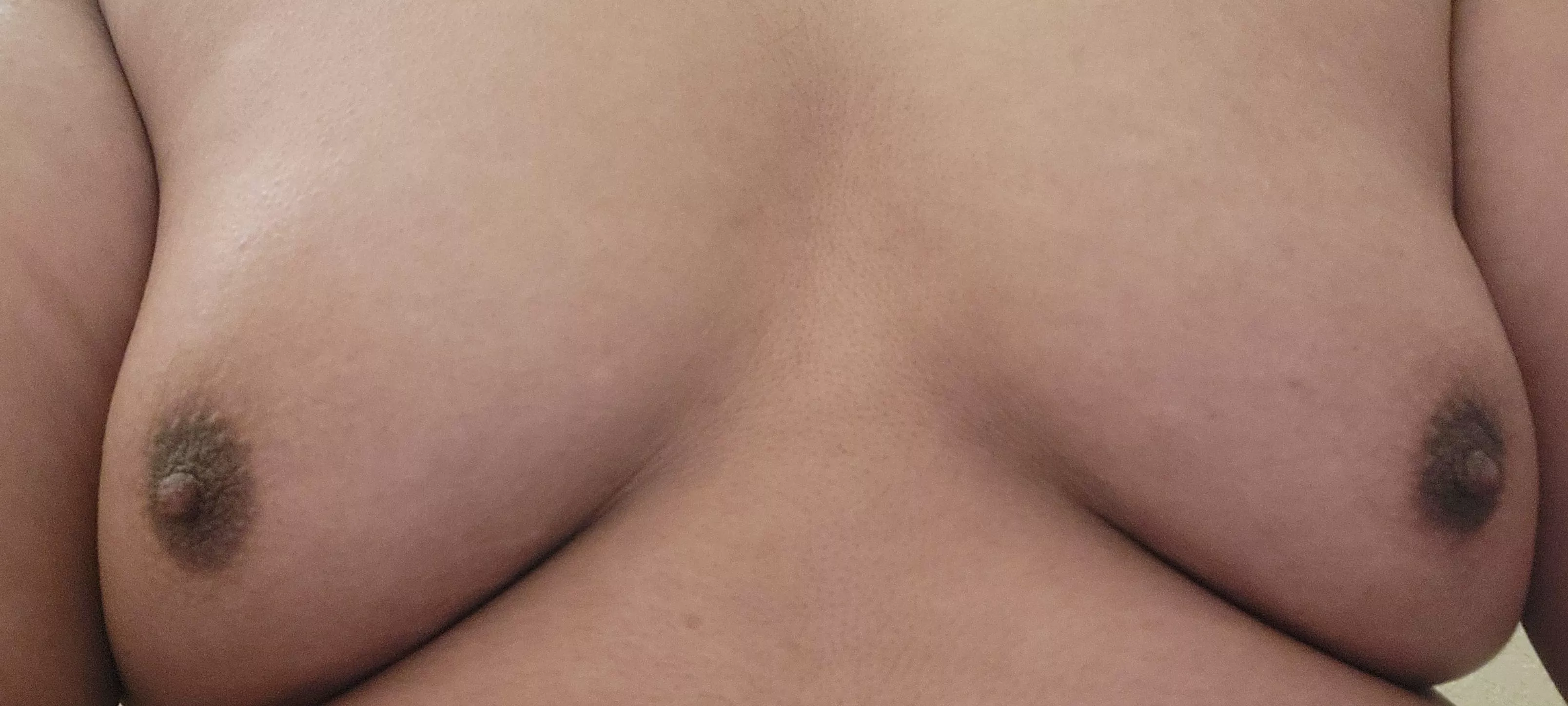 My moobs posted by Milek209