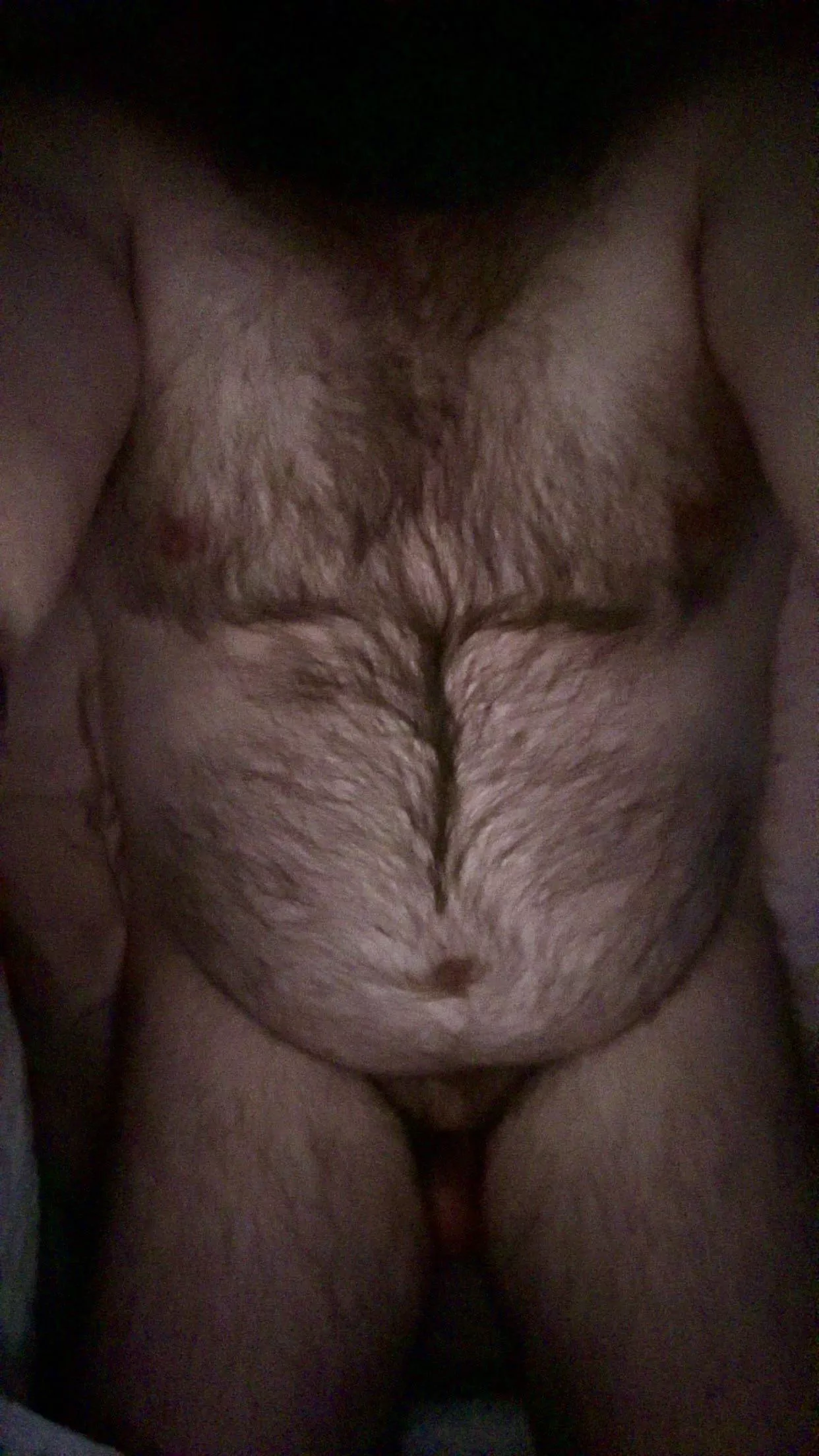 Too hairy? (37m) posted by DadbodBaldBeard