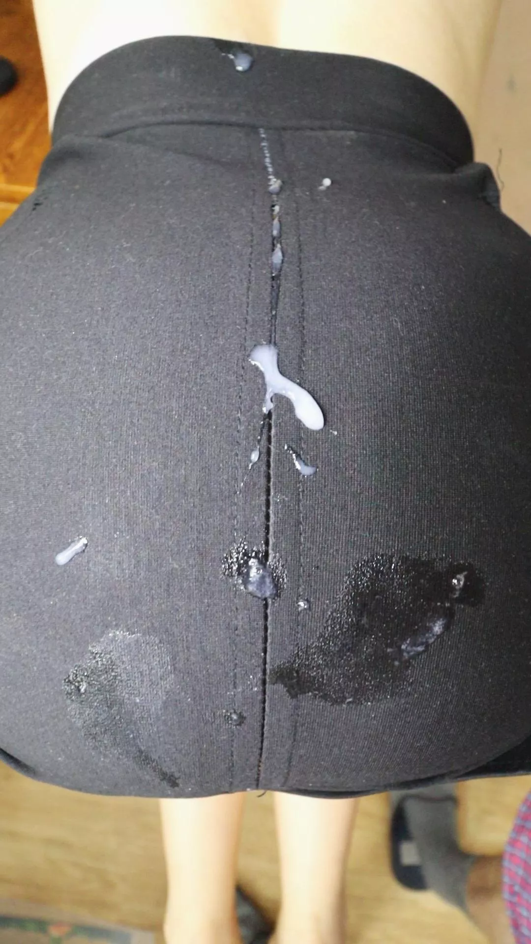 White spots are FOREVER! posted by SanyAny_ph