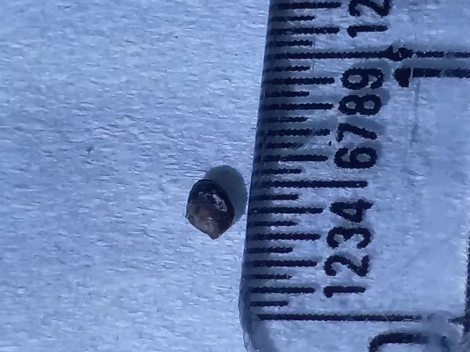 People on r/weird told to post here. I learned this was a dilated pore of winer. Came out while showering. by Abdullah_011235