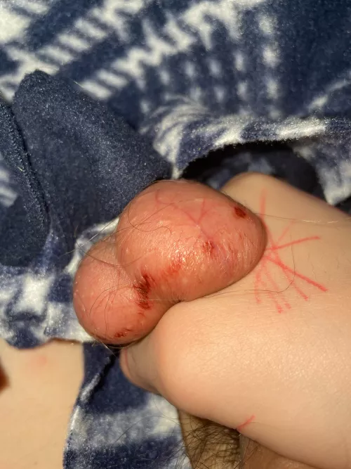 Abused by solekibbles830