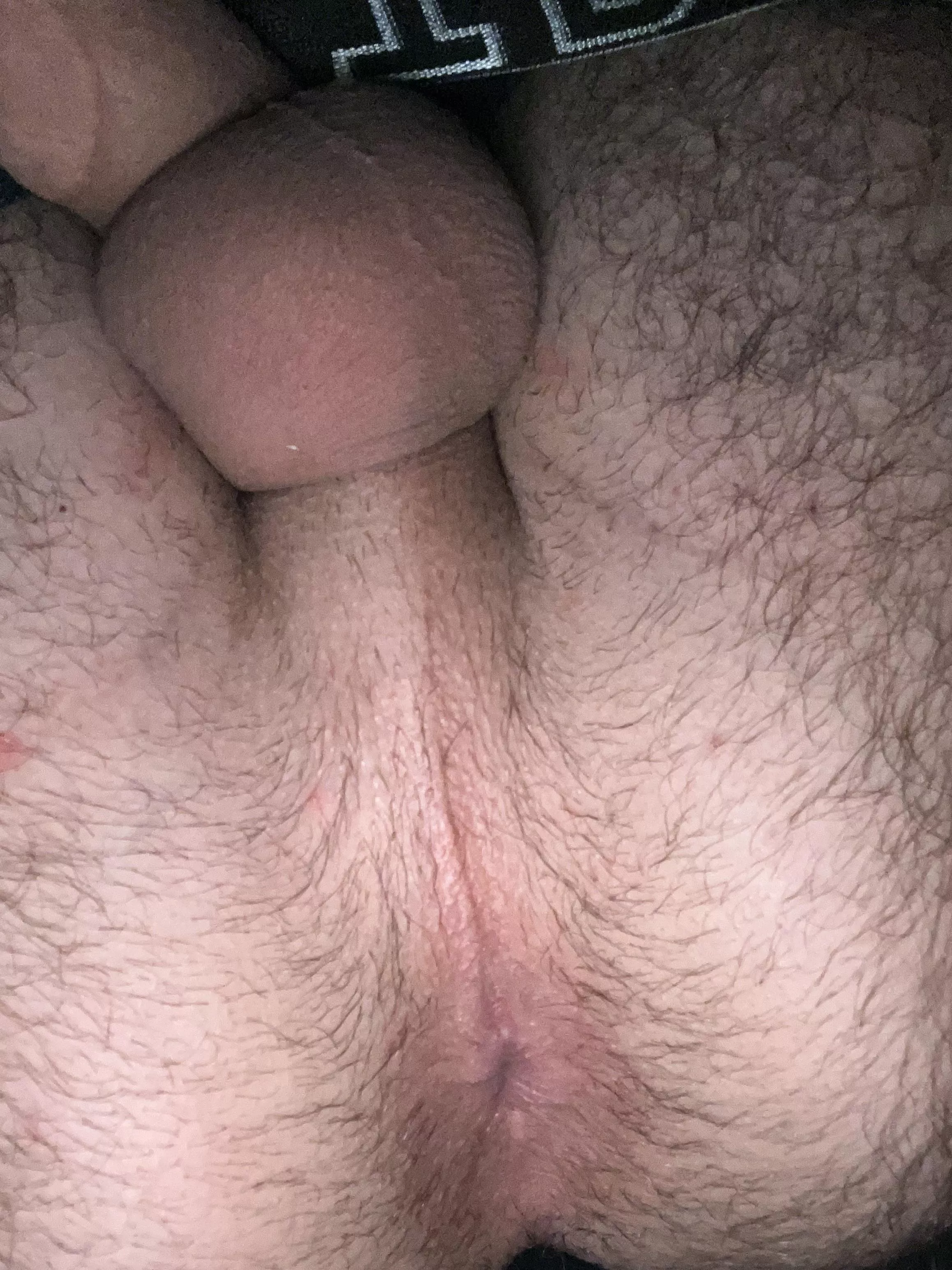 18 m respond with pics posted by Accomplished-Gap-883