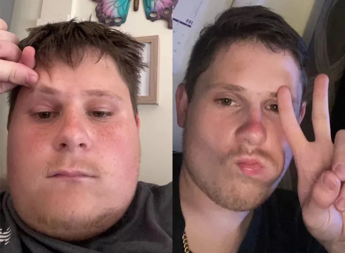Before and after weight loss by Jaylang201