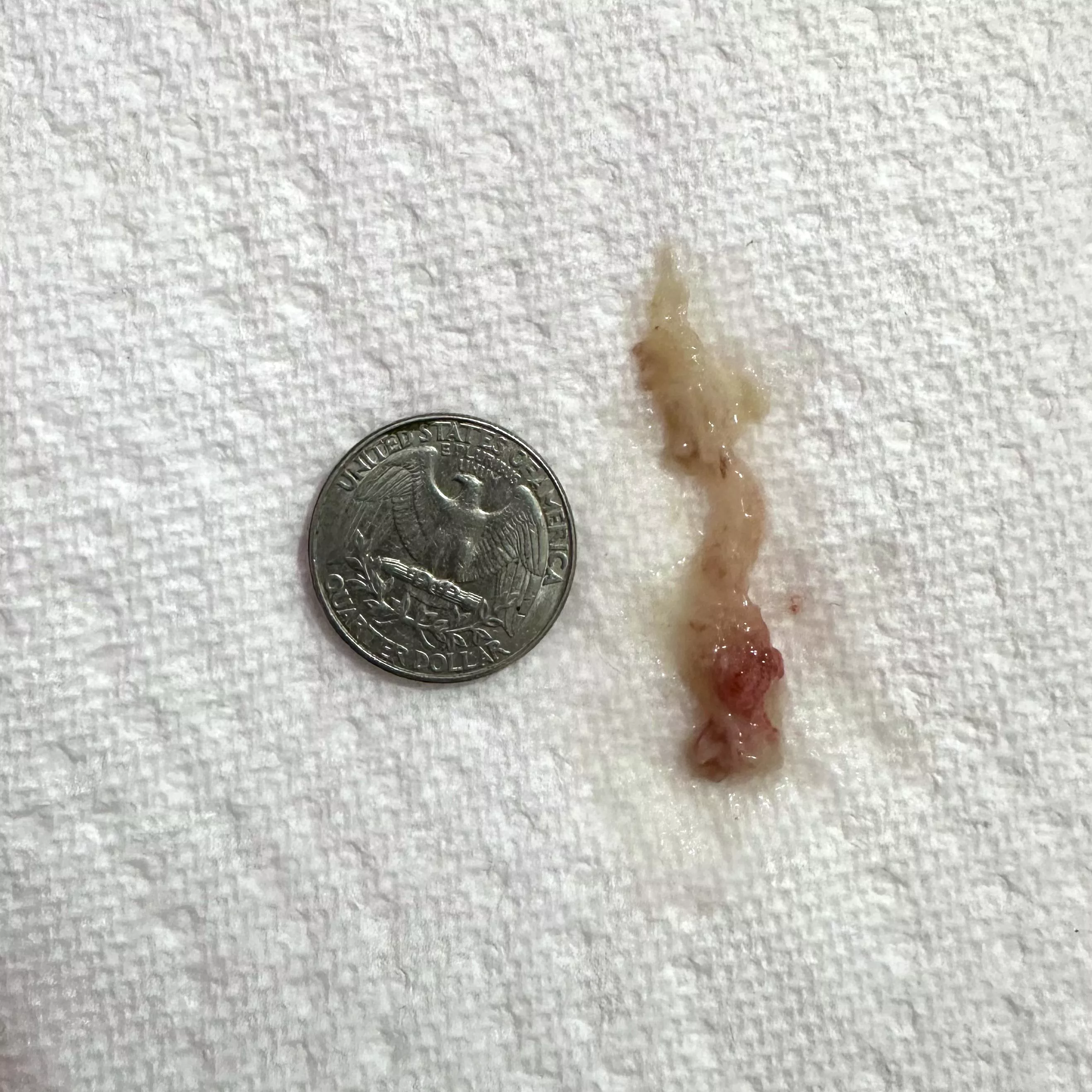 Sneezed huge nasal mucus plug. Been sick for days, such a relief to breathe again posted by Art-Hoe_pdf