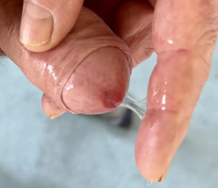 Have a little snack! posted by Justintime1955