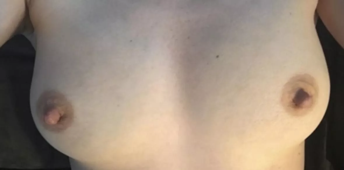 My super pale titties (F) posted by pinkprinces69