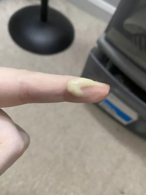 Armpit bump with puss by Vegetable-Tone-5523