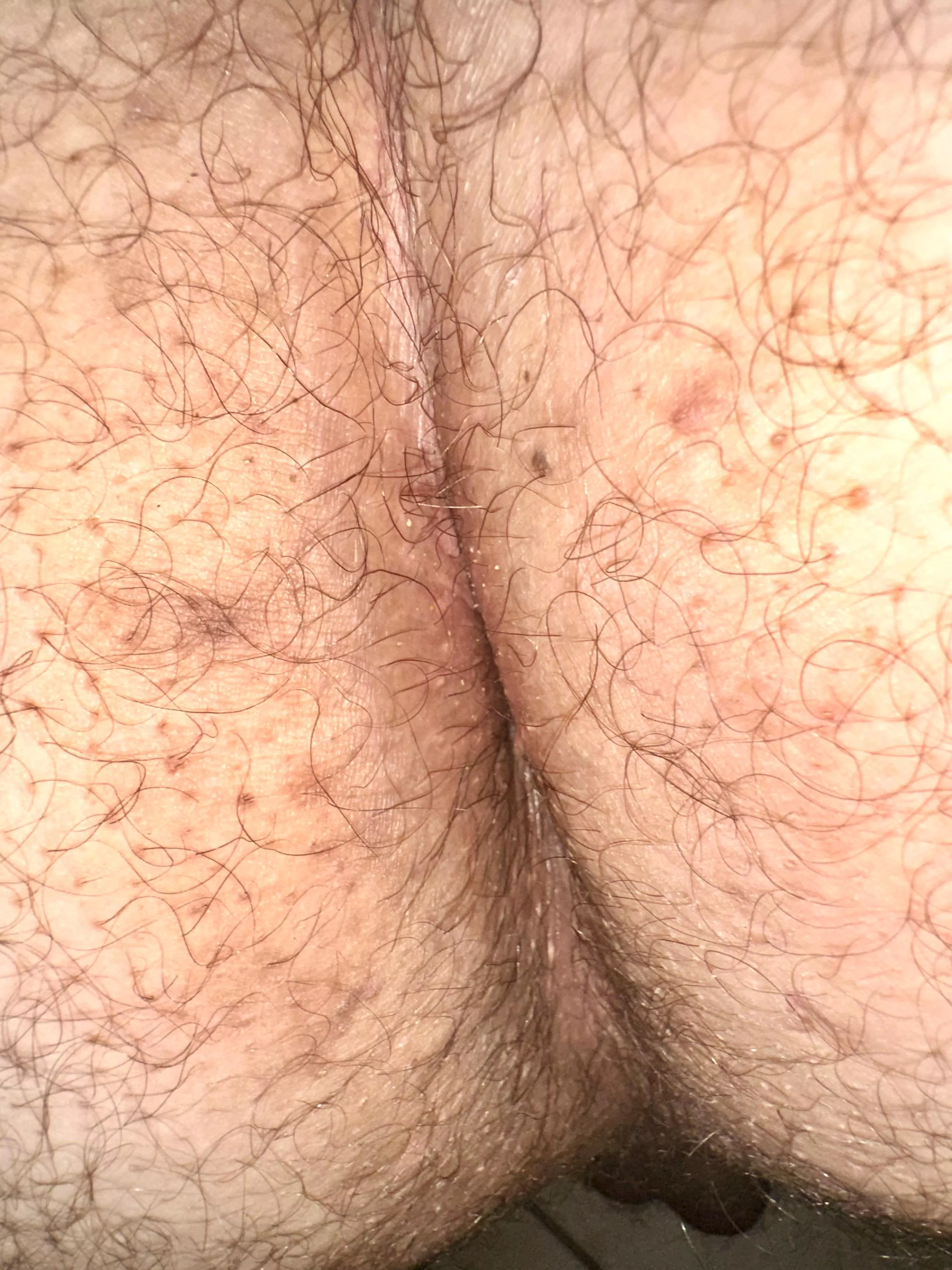 First time sharing hole posted by neonx9