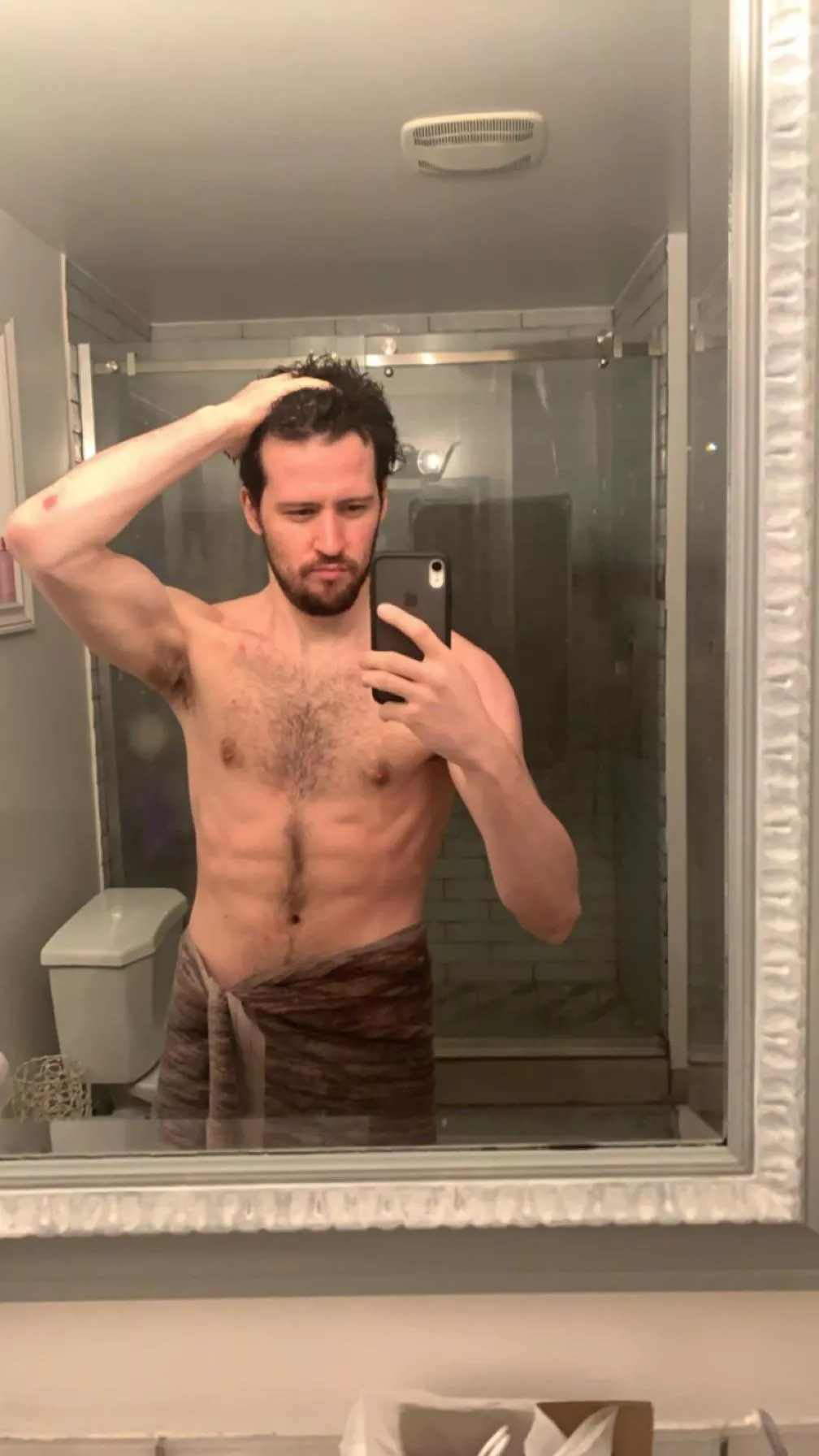 Little banged up from hockey but I can still go ;) posted by HockeyGuy3488