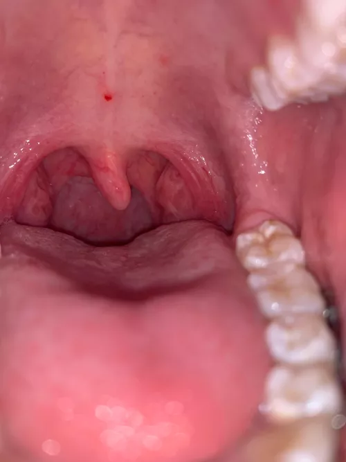 Something red in my mouth and it keeps moving by Silver_Boot_8630