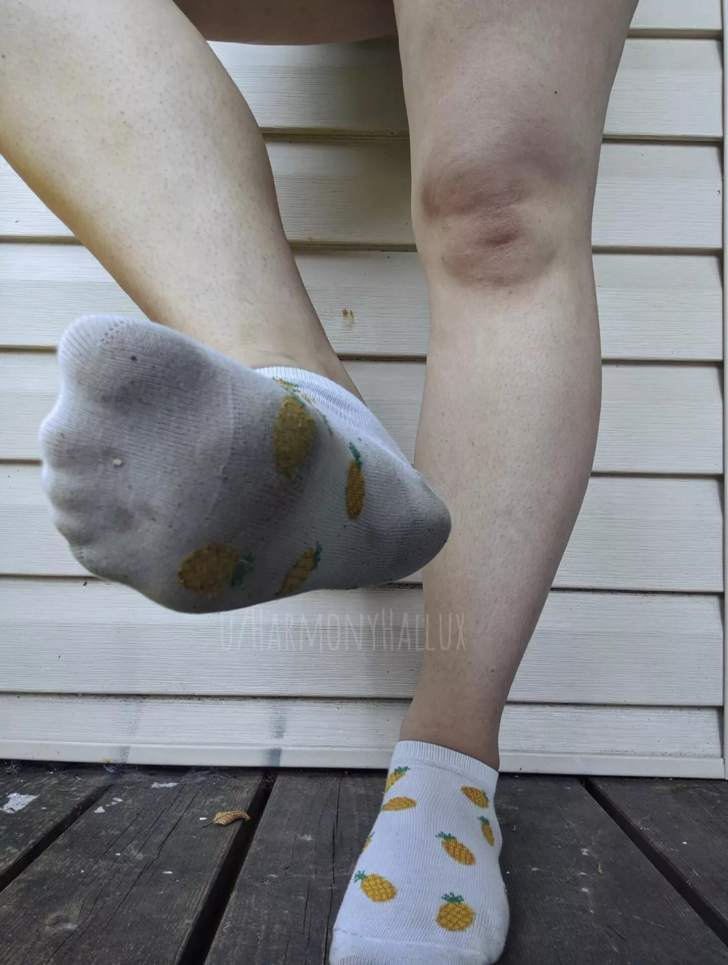 Do You Even Need The Socks Off? My Toe Prints Are Right Here 👅 posted by HarmonyHallux