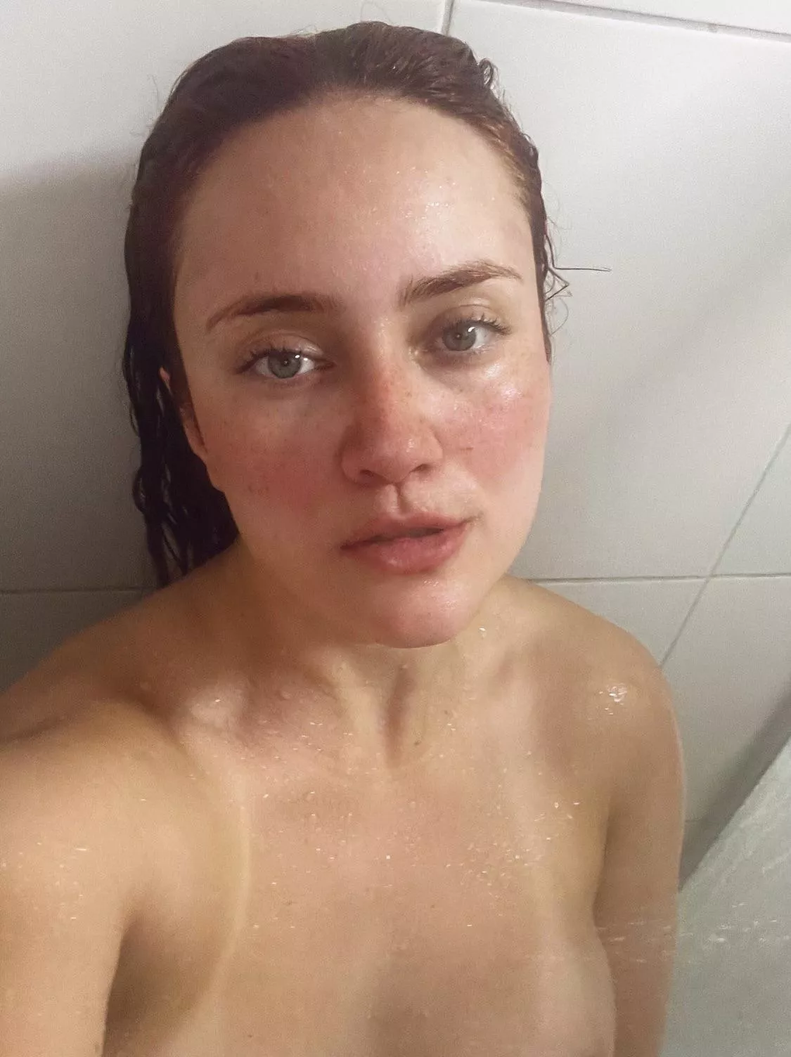 My eyes are up here. My freckles are everywhere. [IRTR] posted by Puzzled_MJ