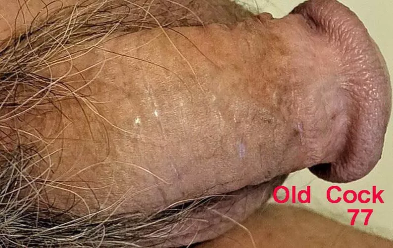 76 Years and Tired by Maximum-Sleep-5613