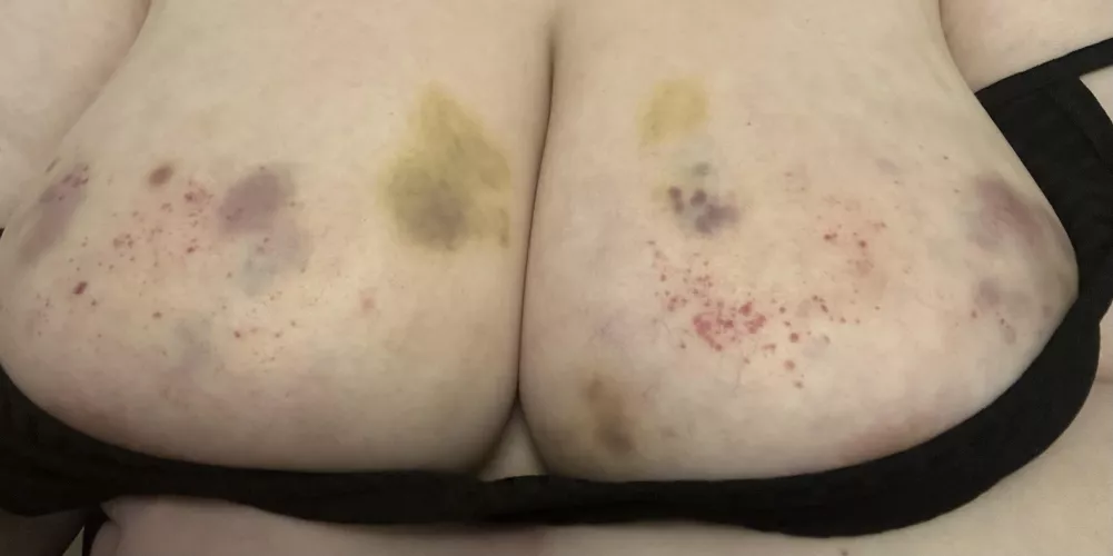 Beaten breasts are best by Timely_Warthog_2731