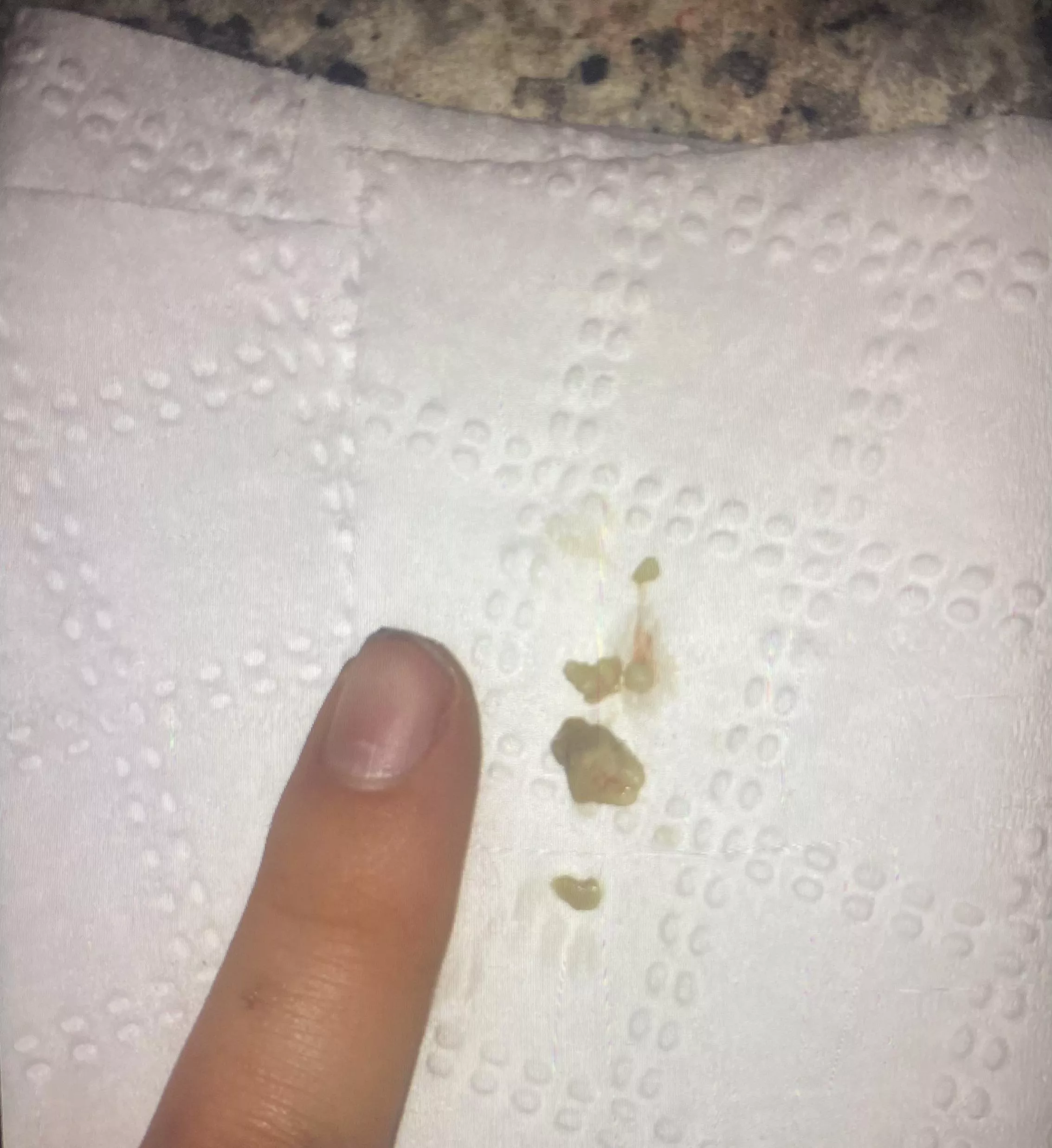 This one was from a few years ago. Biggest one I’ve ever had. posted by salsalsass