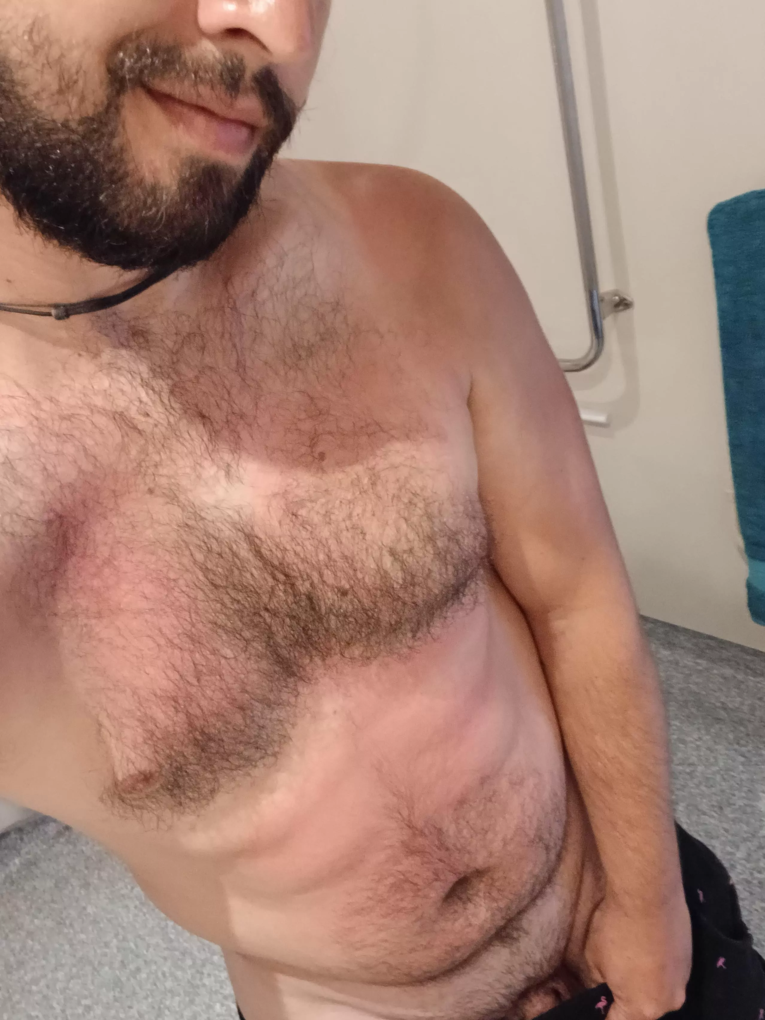 Help wanted: Help me recover from this light sunburn posted by SantanRicoda