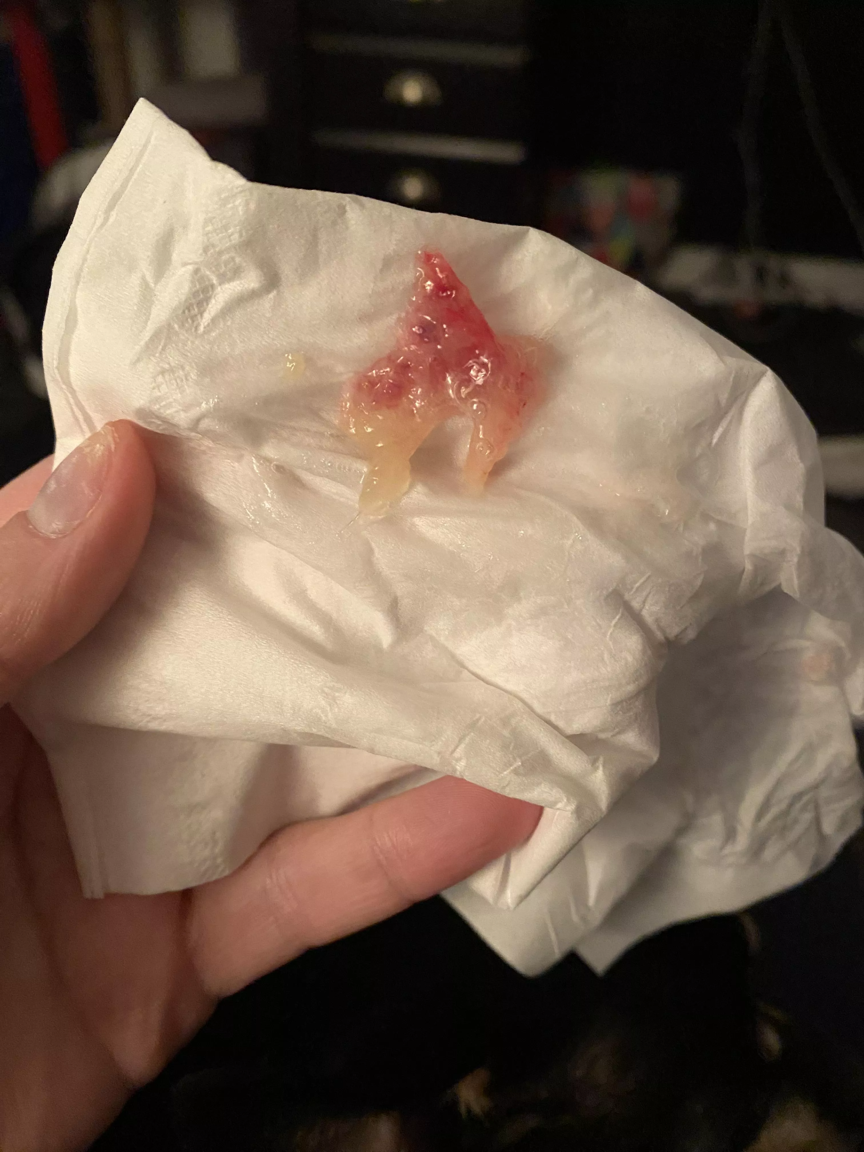 It’s me again! Blew out another polyp (?) posted by crimsonlights