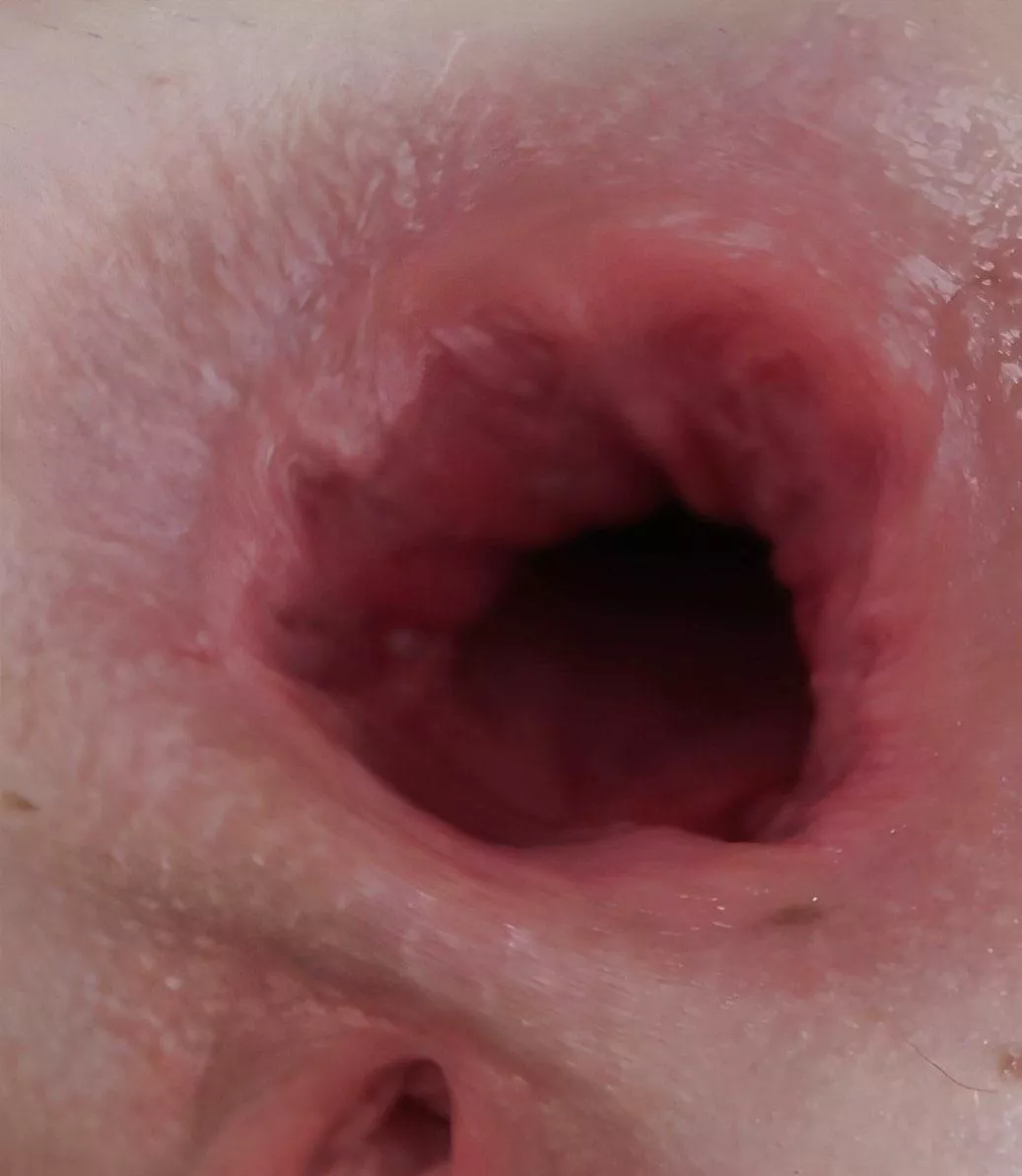 Massive gape posted by Gooneruk69