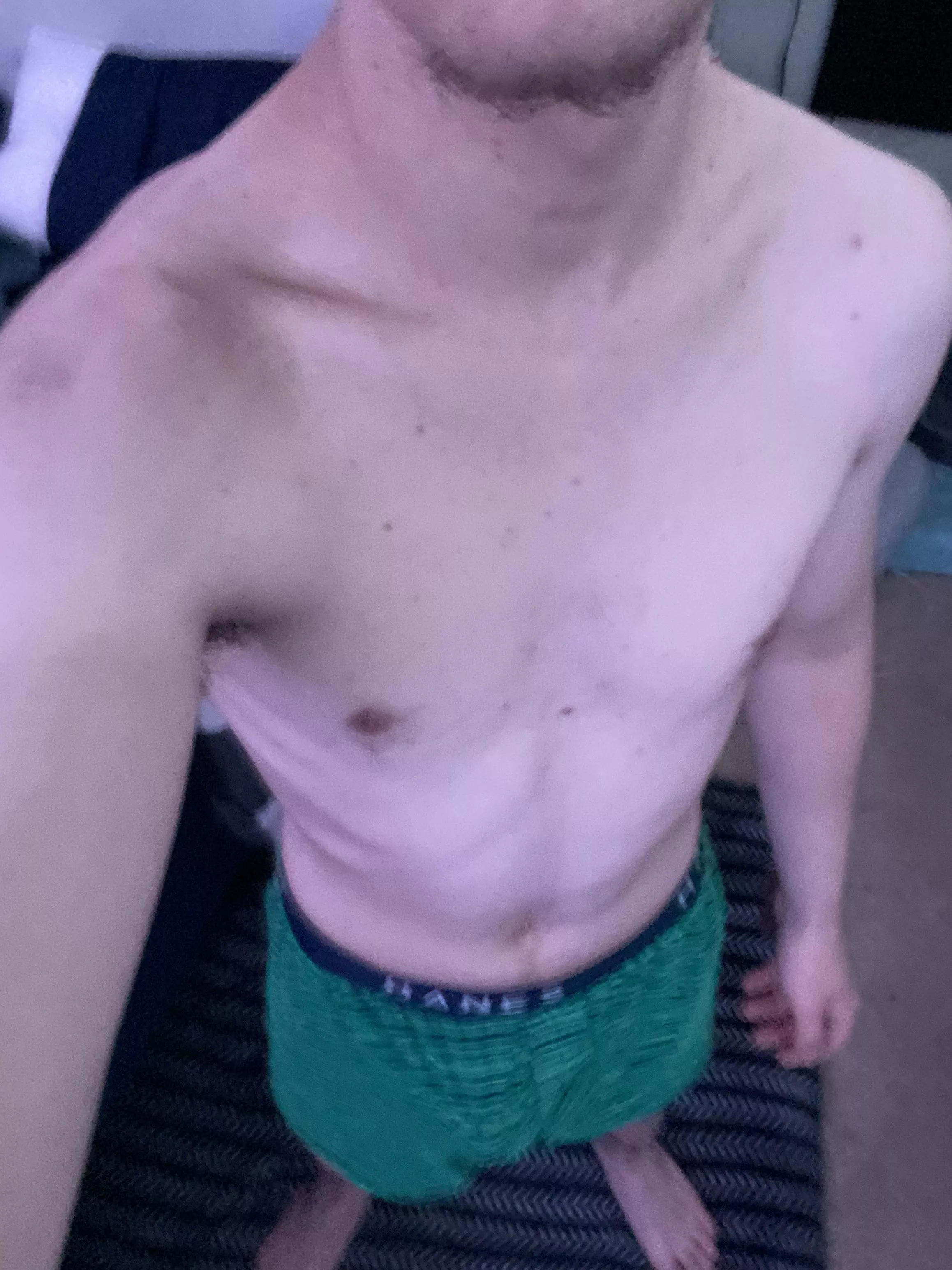 Should i take them off??? posted by colwinz_