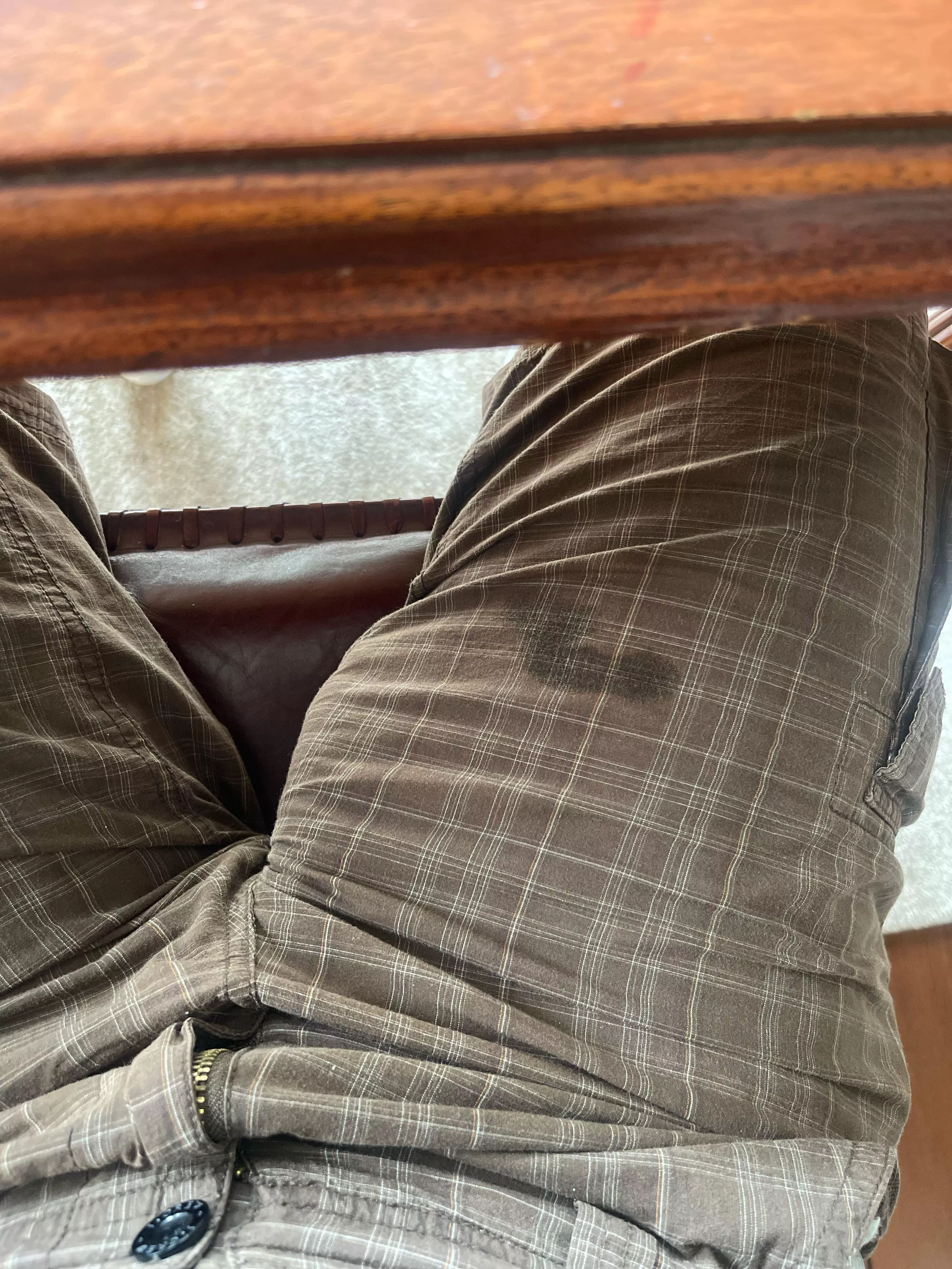 Downside of freeballing posted by basss123456