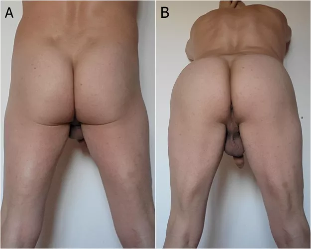 How should I present myself for you? A or B by holy6859