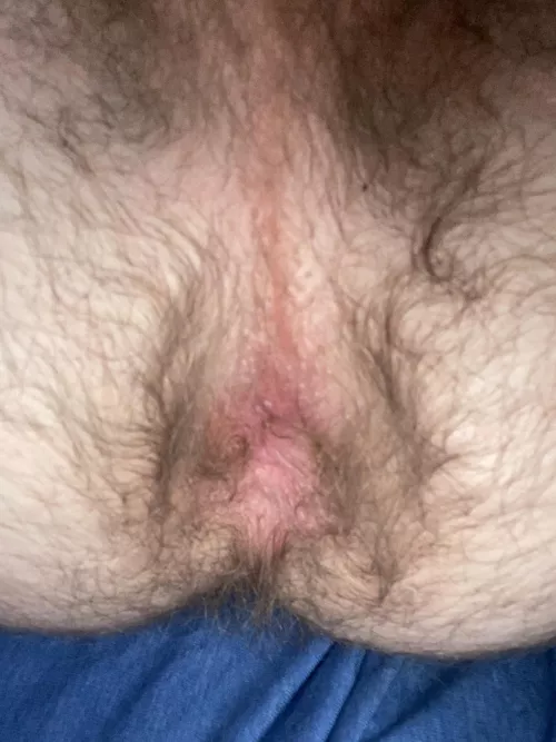 I’ve been told my ass is too hairy, what do you think? by Outside-Landscape712