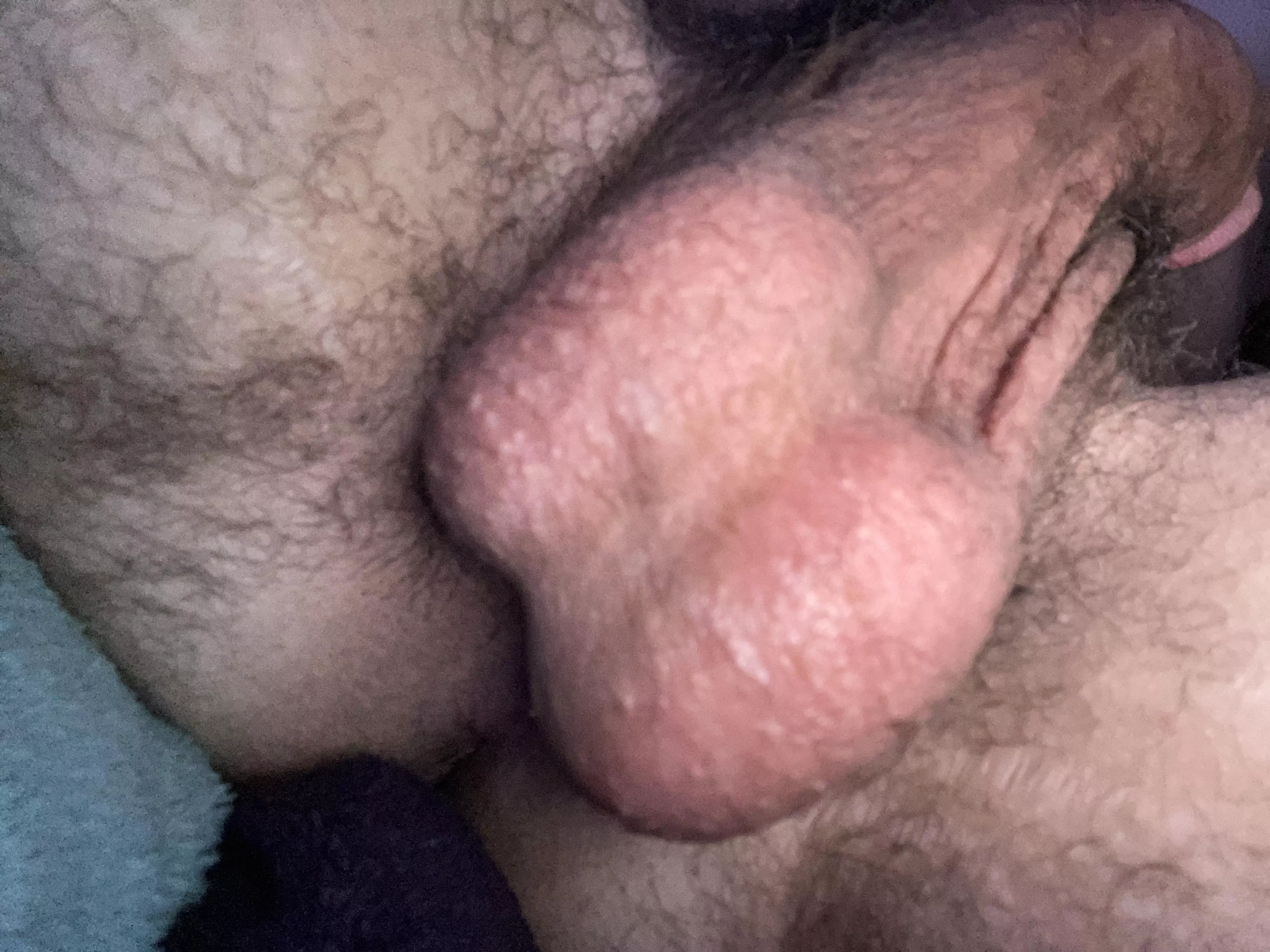 Balls? posted by colwinz_