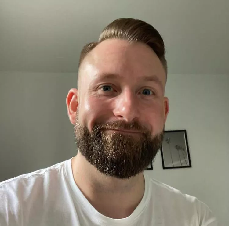 Do you think shaving my beard will make me look better?? posted by Global_Mammoth_8401