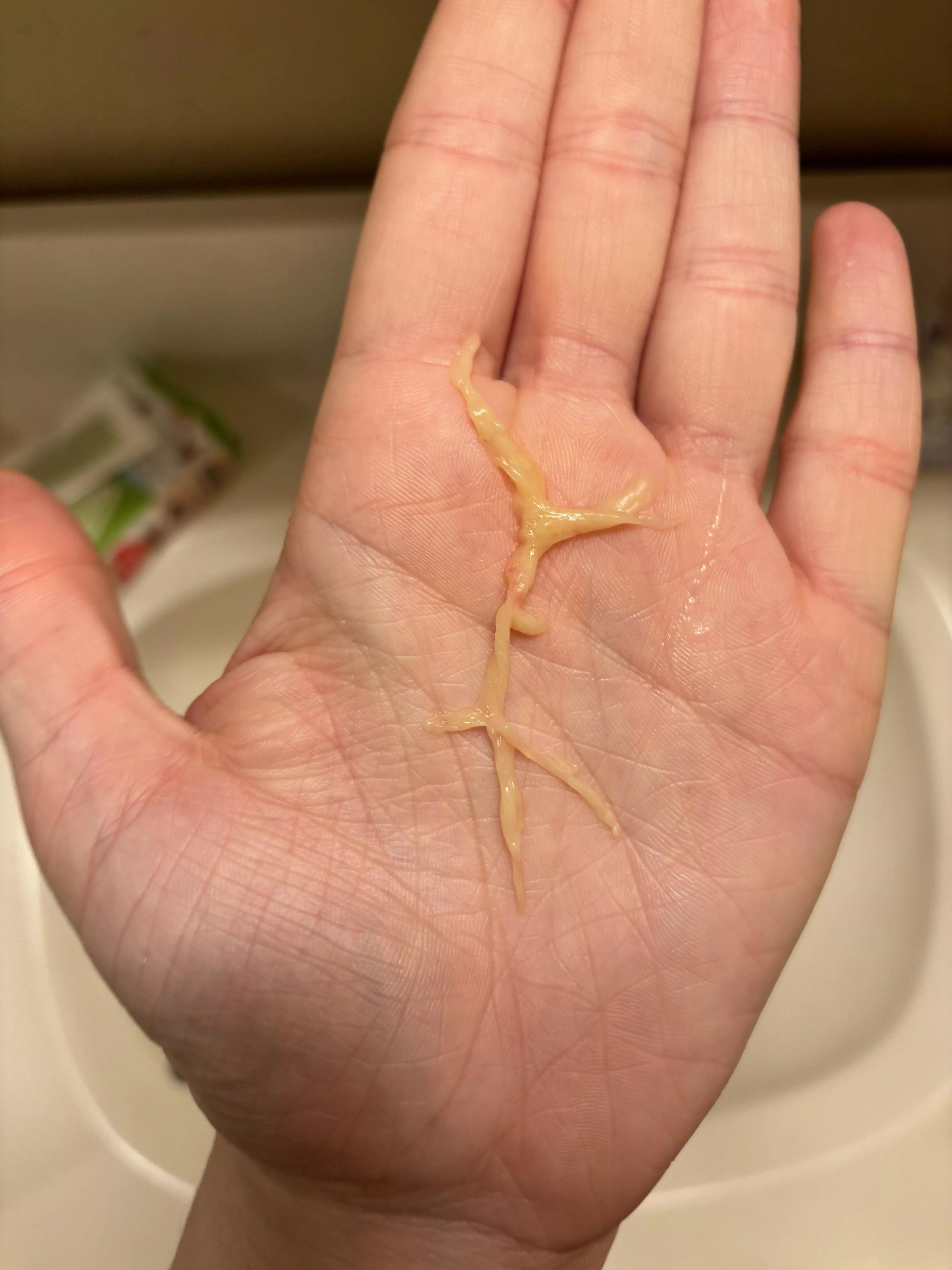 Lil’ bronchial caste posted by lnmcg