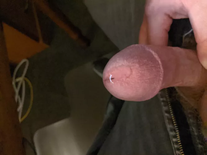 My leaky mushroom by SurpriseBusy6241