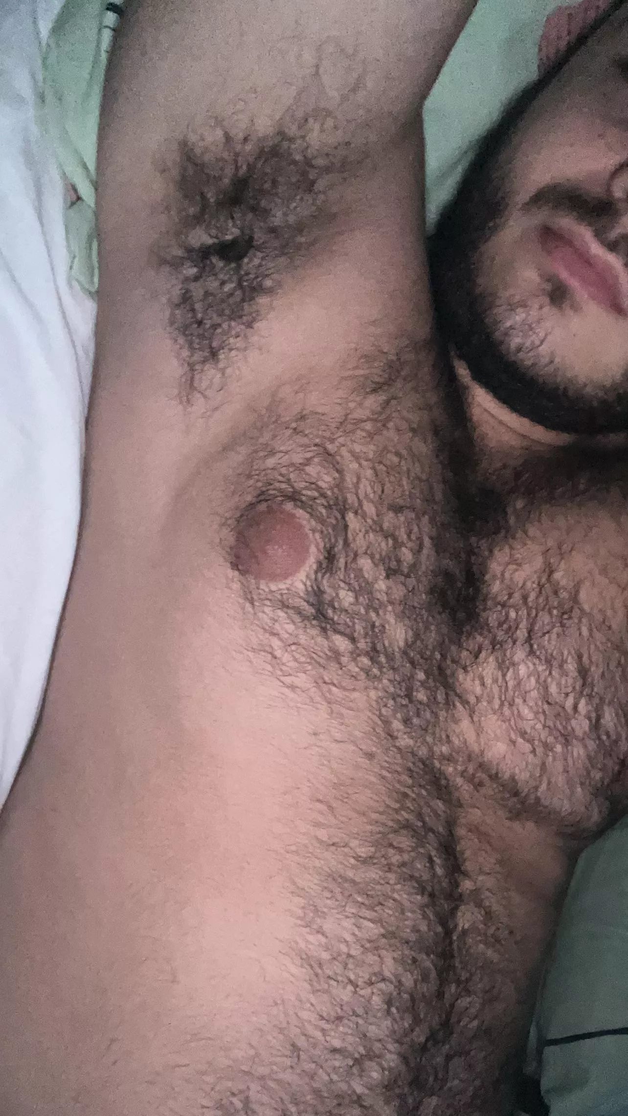 Hairy posted by Former_Judge6015