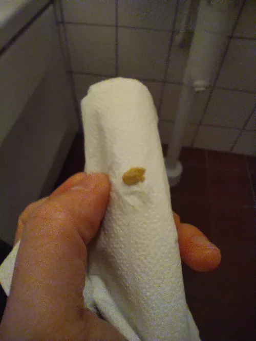 A gift from my tonsils by Slcubr