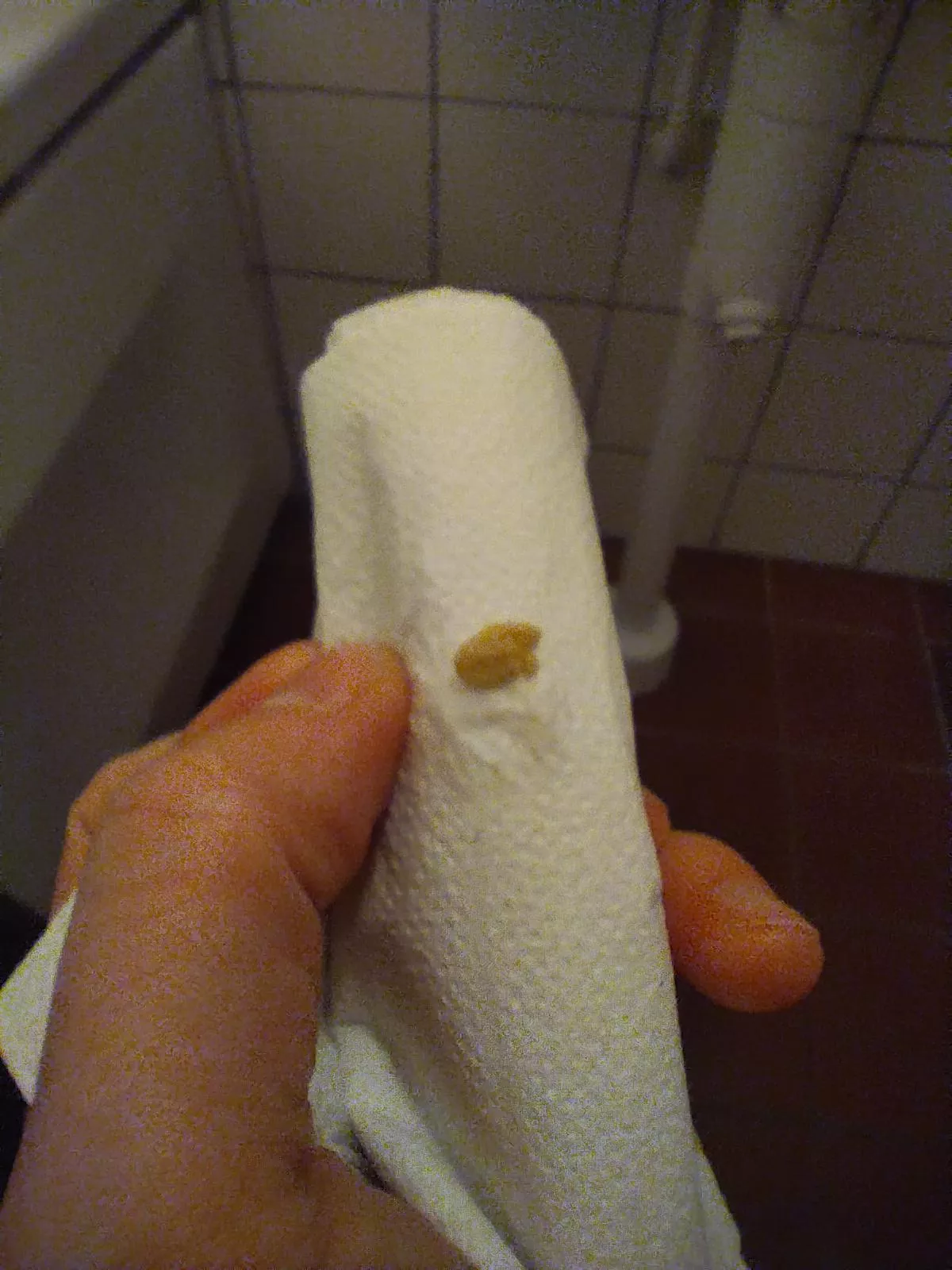 A gift from my tonsils posted by Slcubr