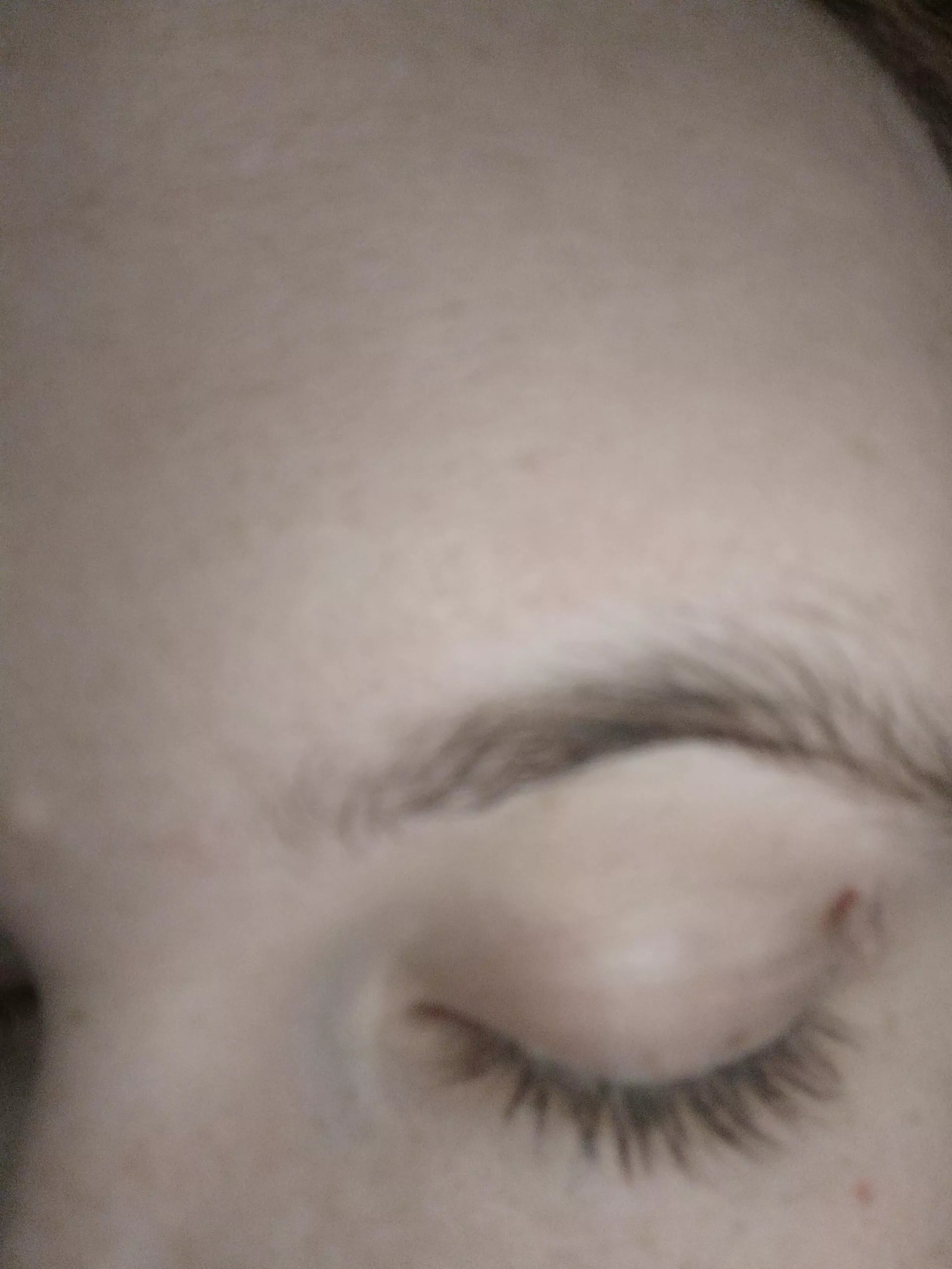 How to remove this skin tag? posted by bonesstackedonfloor