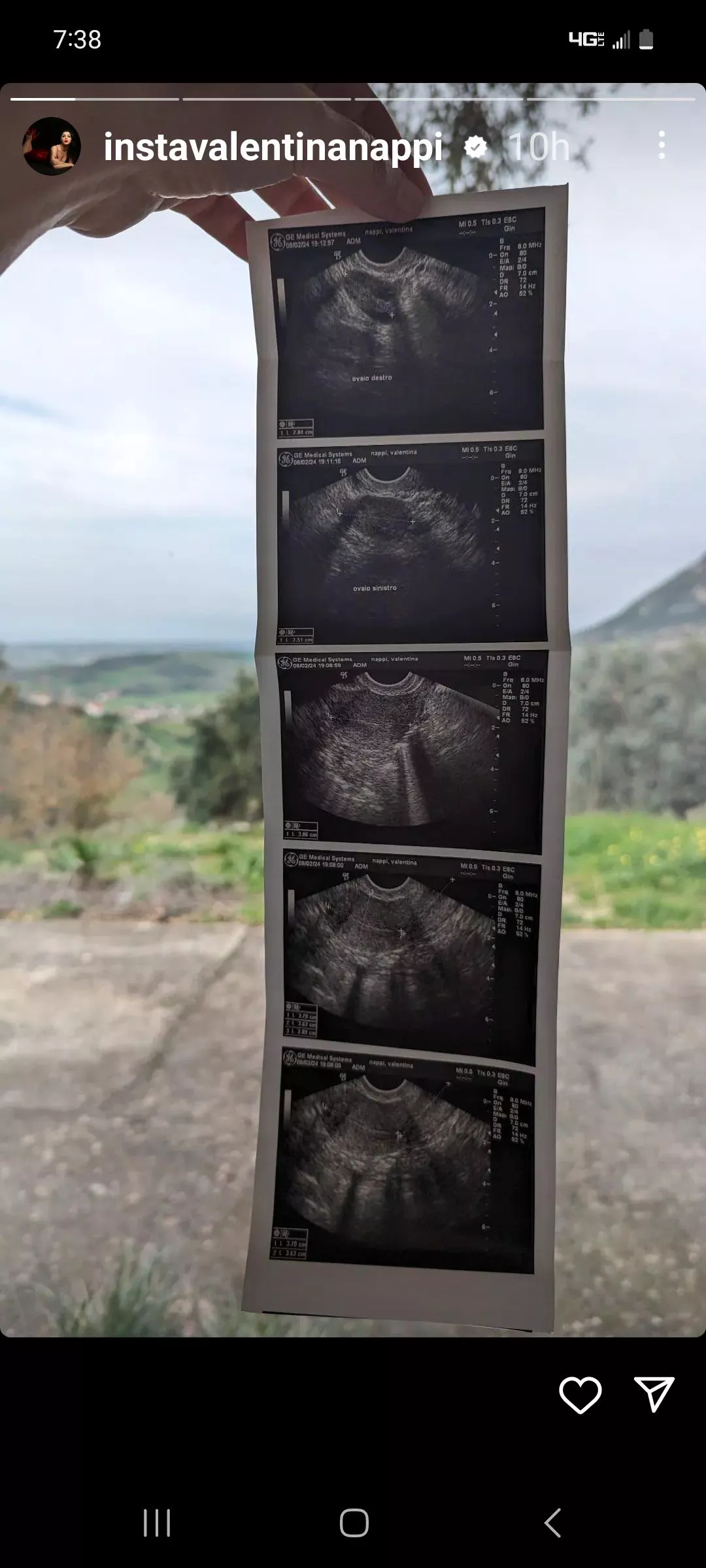 Valentina pregnant? posted by traderneal57