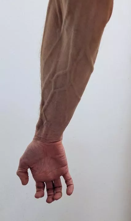 Did I post this in vein? posted by oldmangeorge