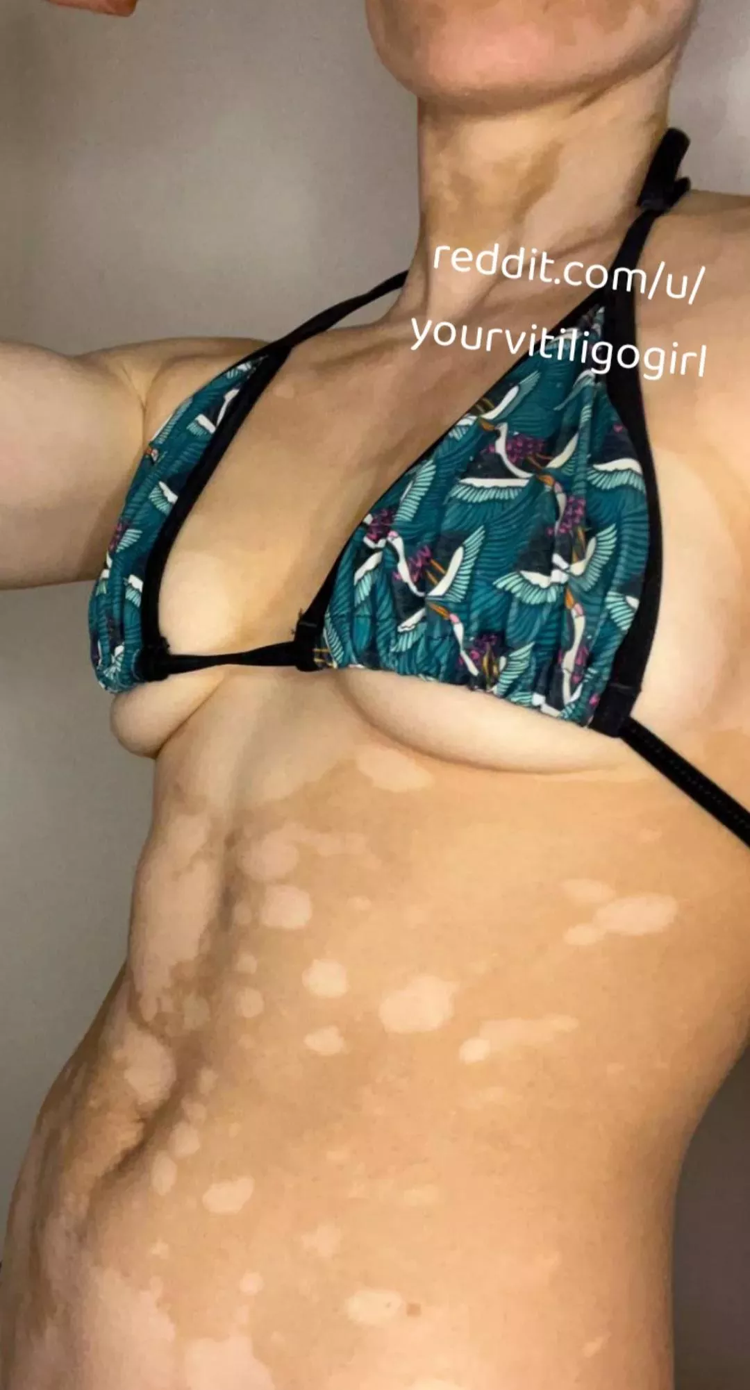 Fit girl horny searching for dicks posted by yourvitiligogirl