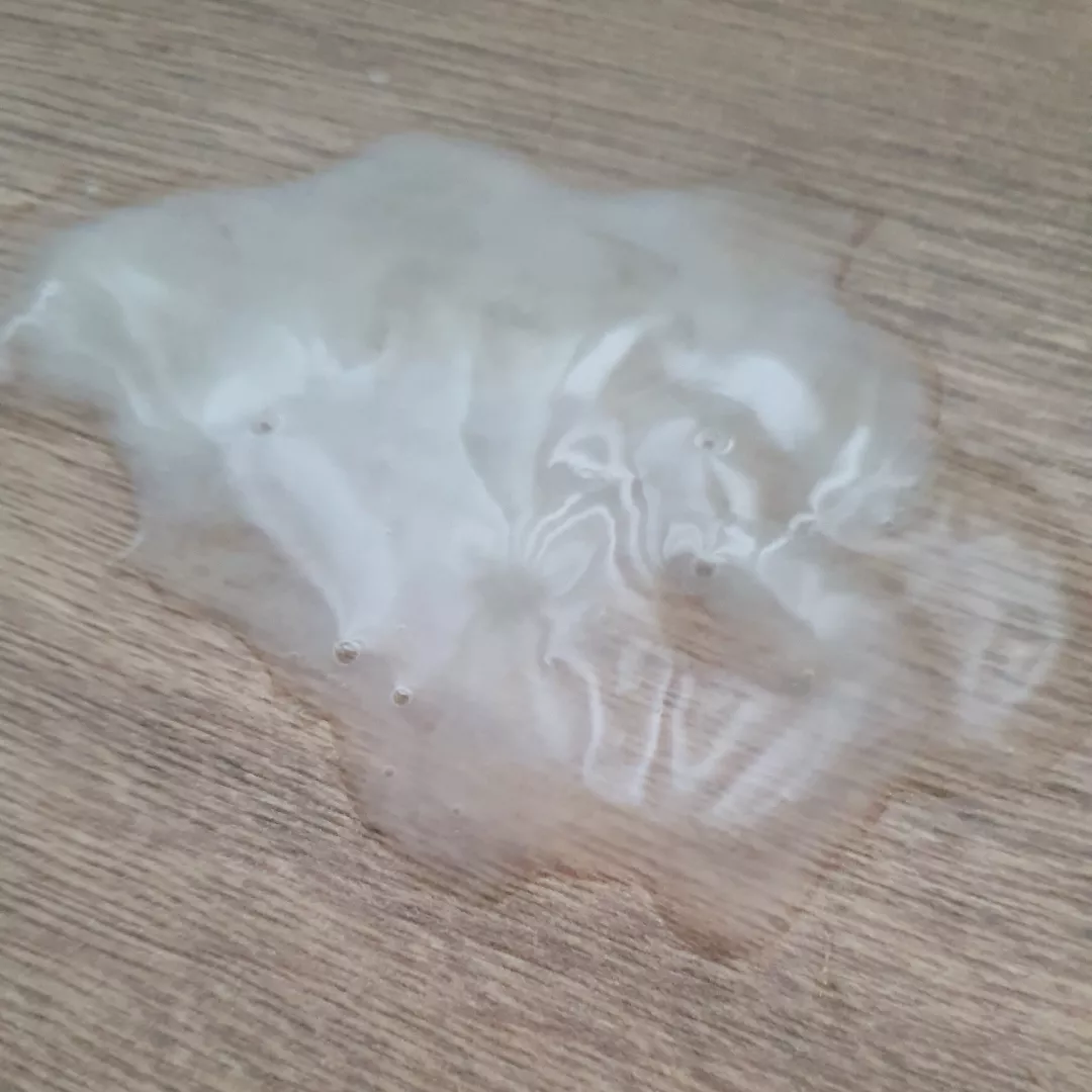 Now what?.... posted by Frietjespeciaal2