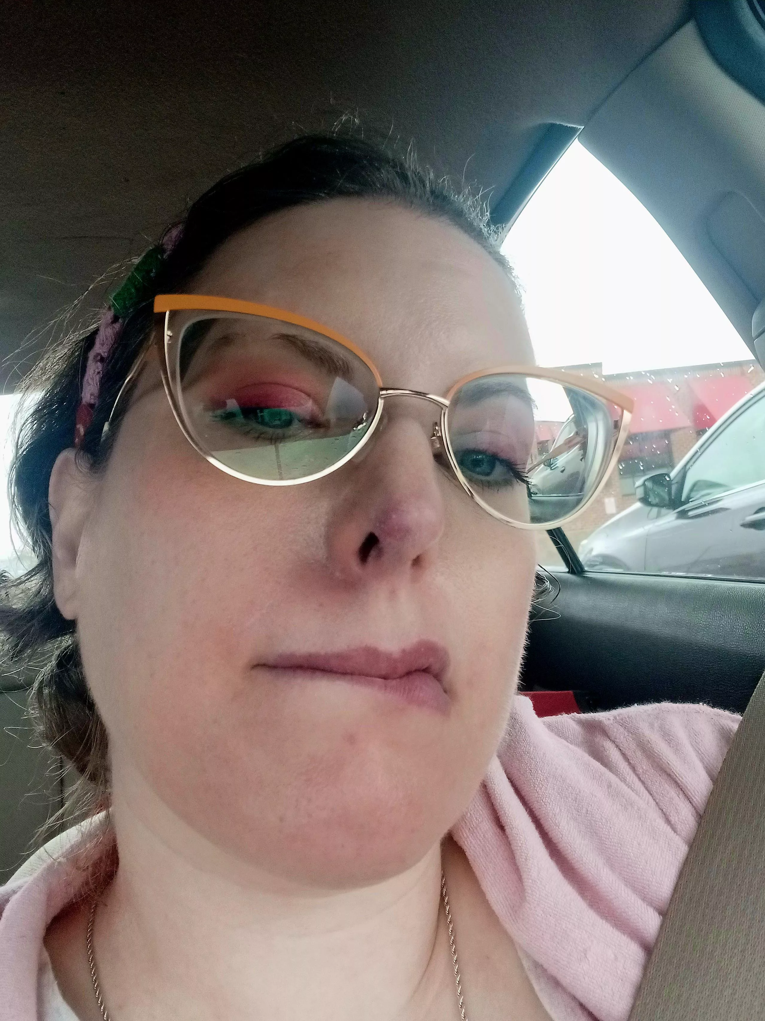 Unpoppable possible MRSA on/in my nose, been the bane of my existence for a couple weeks now. posted by RattieMattie