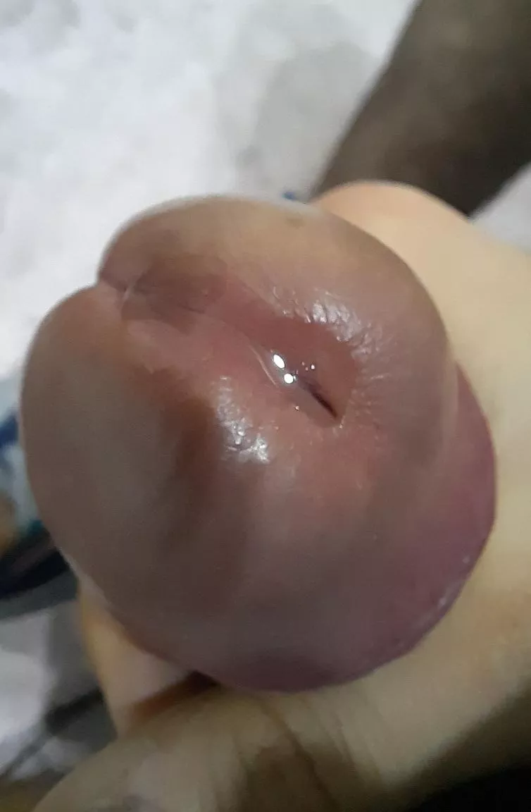 Anyone wants to lick it? posted by Mountain-Arm6542